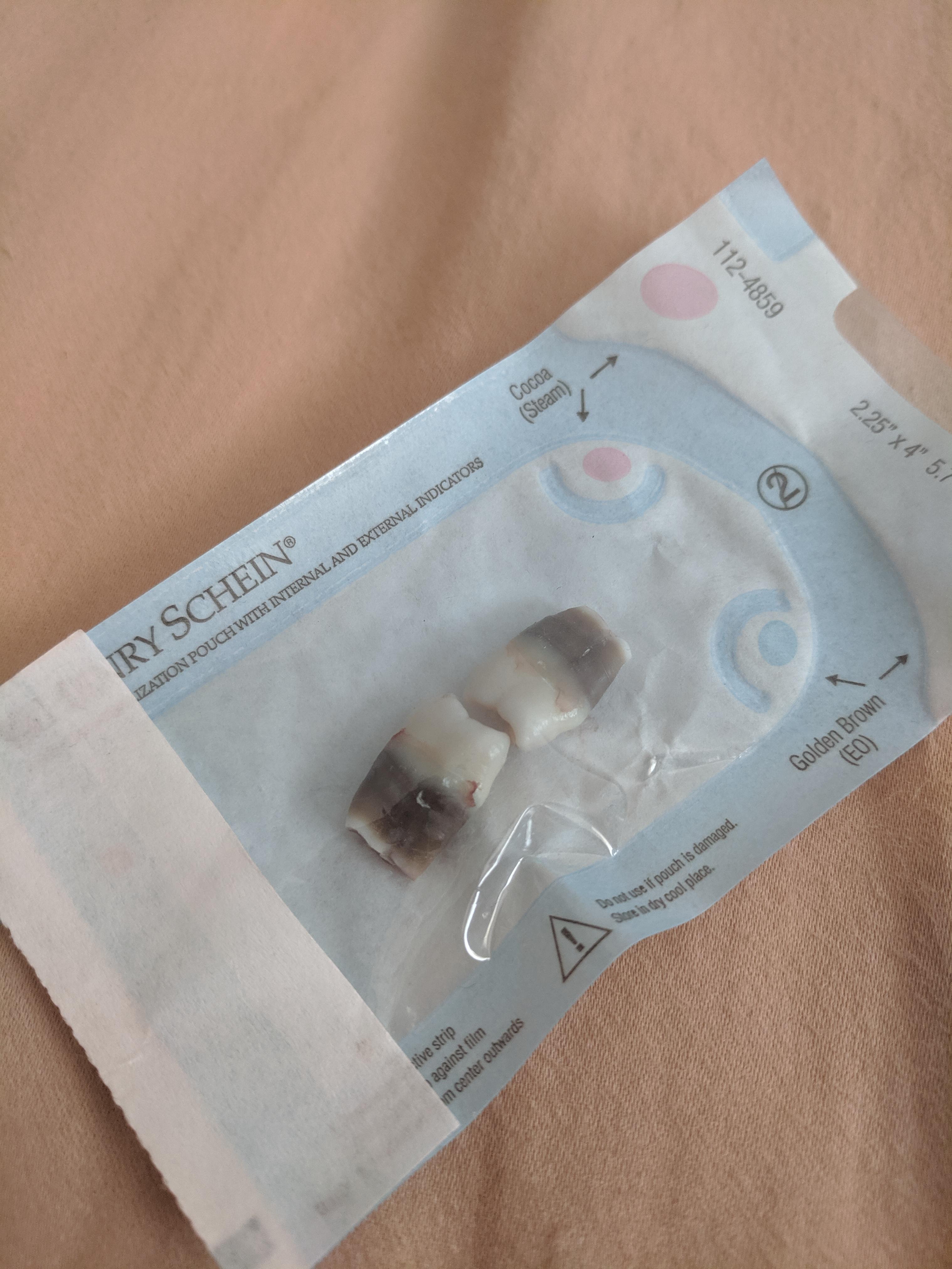 Taking Antibiotics, Like Acne Medication, While Your Wisdom Teeth Are Growing In Will Cause Black Bands To Form Around Them. They Are Not Detrimental In Any Way, As Well! : R/Mildlyinteresting