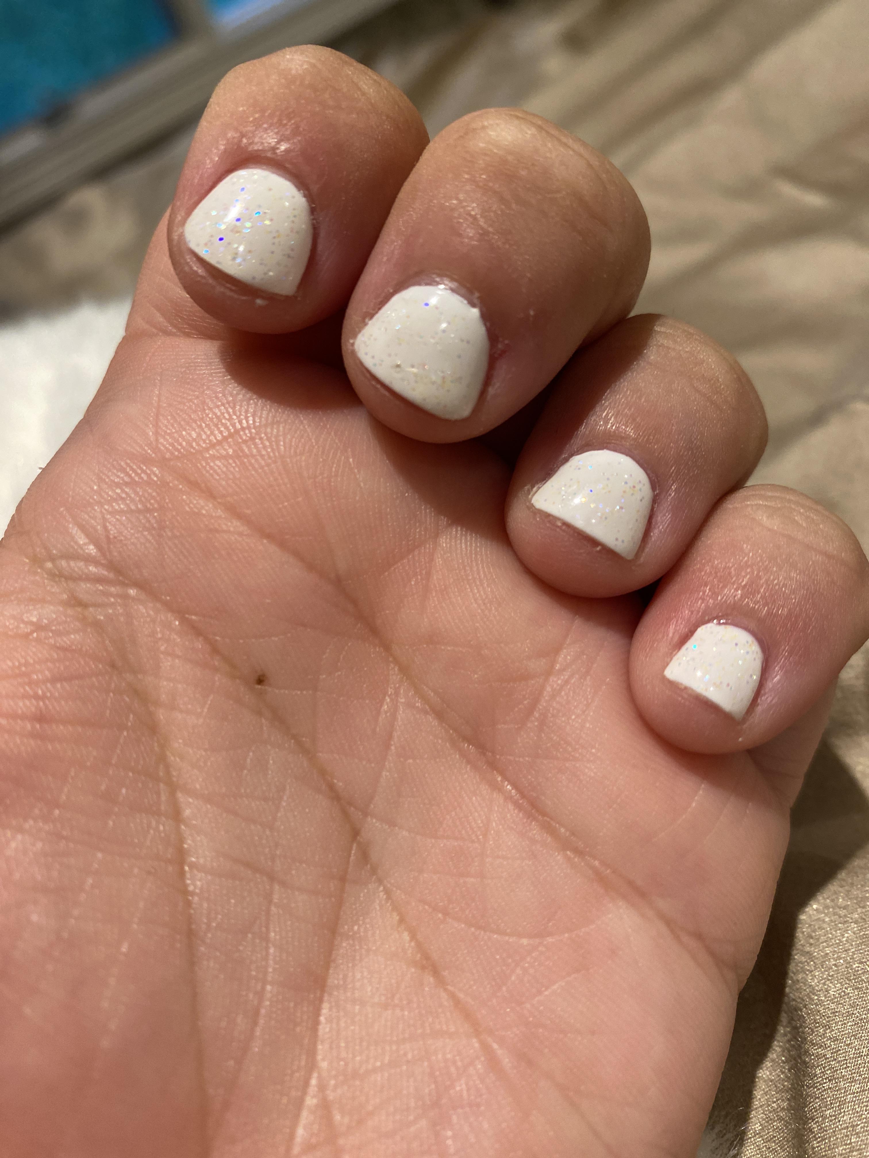 My nails naturally grow outward. Does anyone know how to fix this? Or