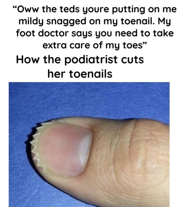 podiatrists making your job harder by cutting patient/residents nails at jagged and sharp angles