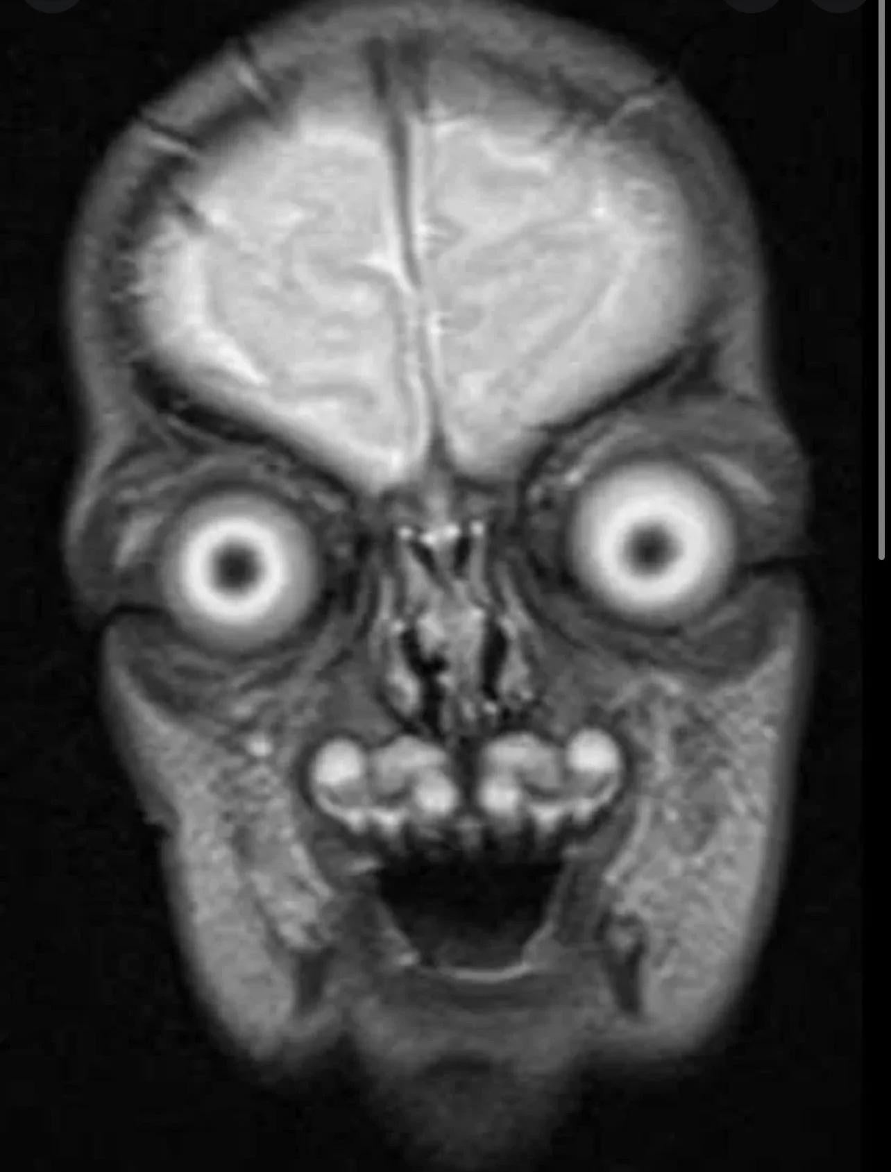 MRI of baby's face r/oddlyterrifying
