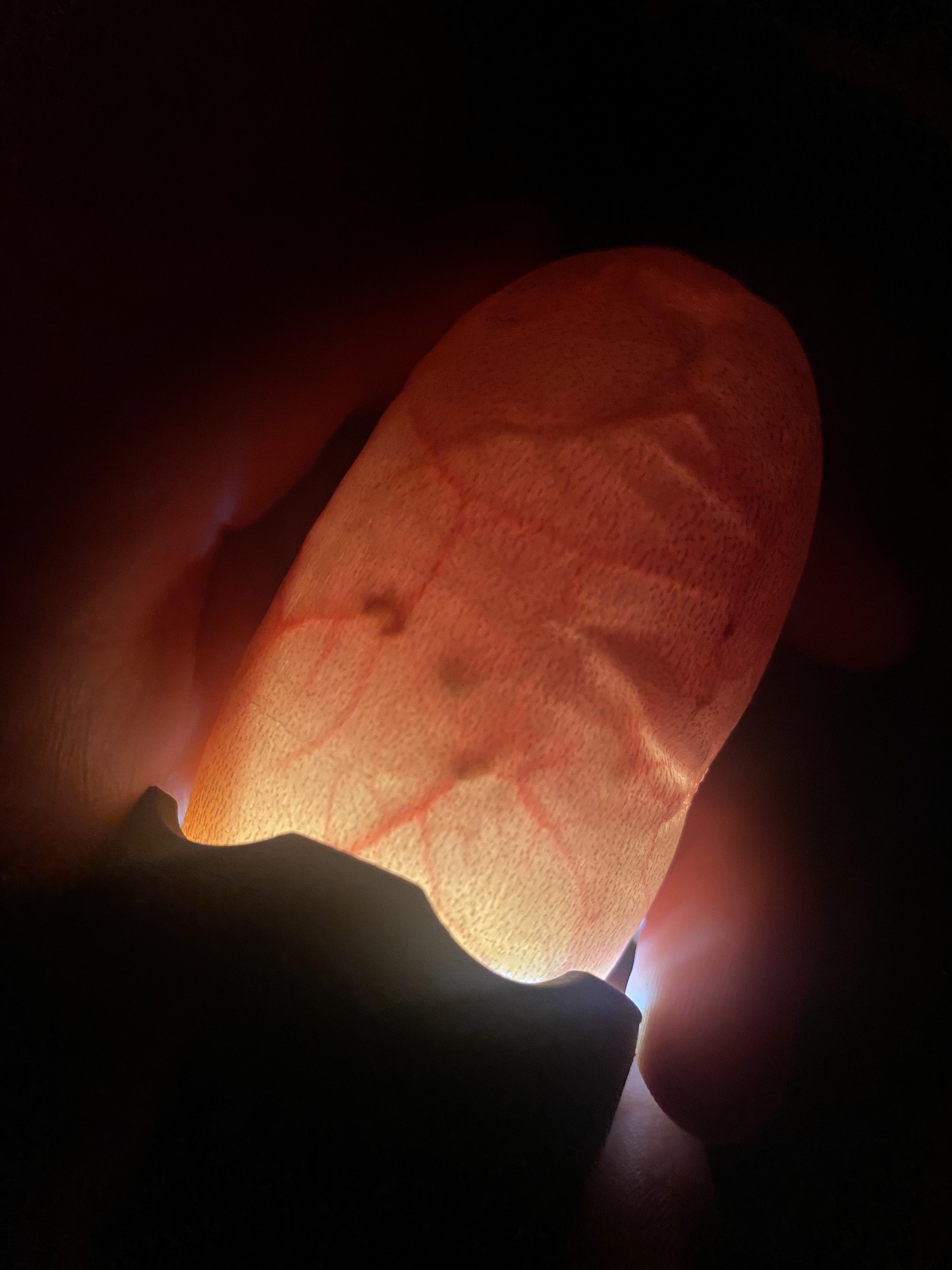 Ball Python egg, 17 days since laid, has these dots when being candled