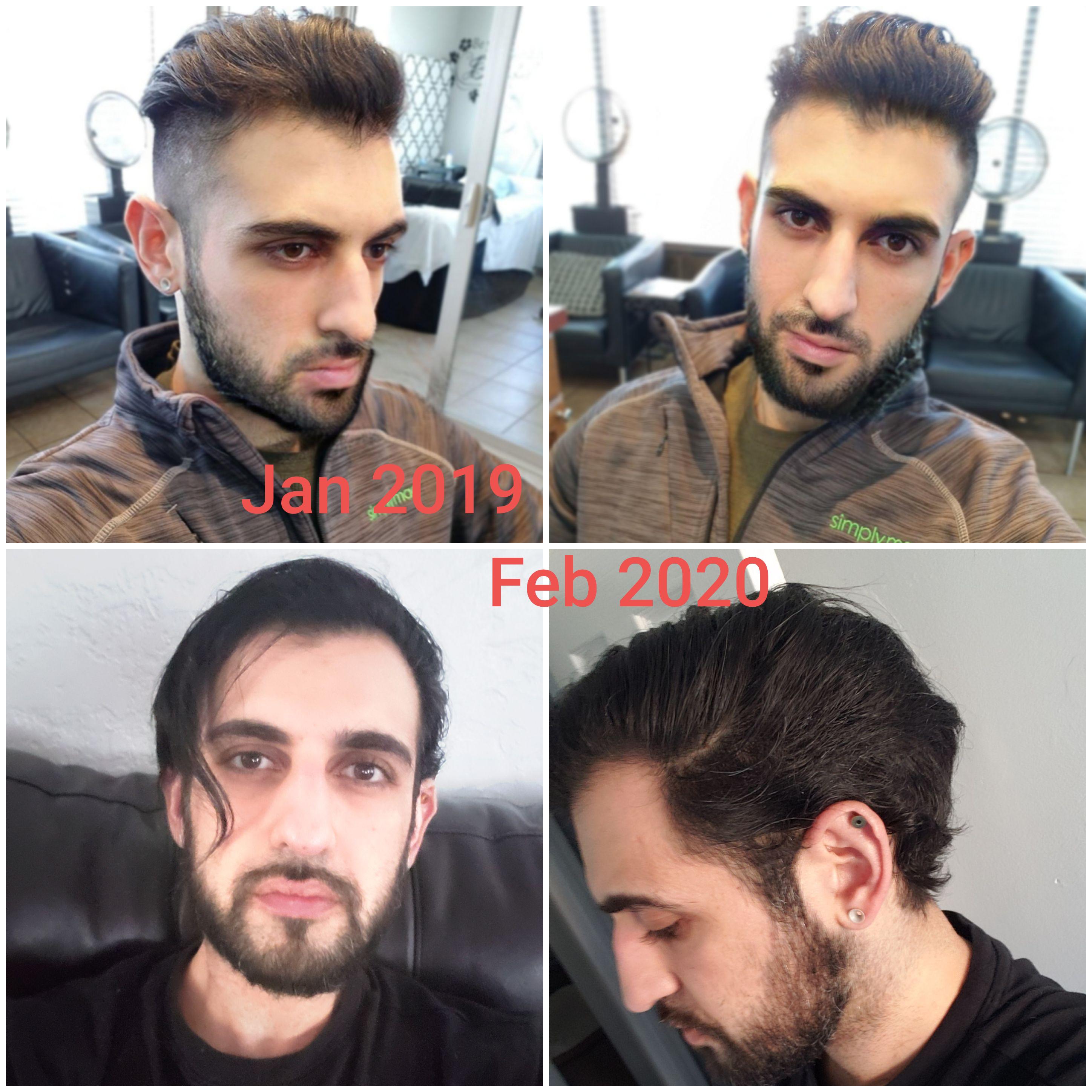 Aggregate more than 82 reasons for slow hair growth best in.eteachers