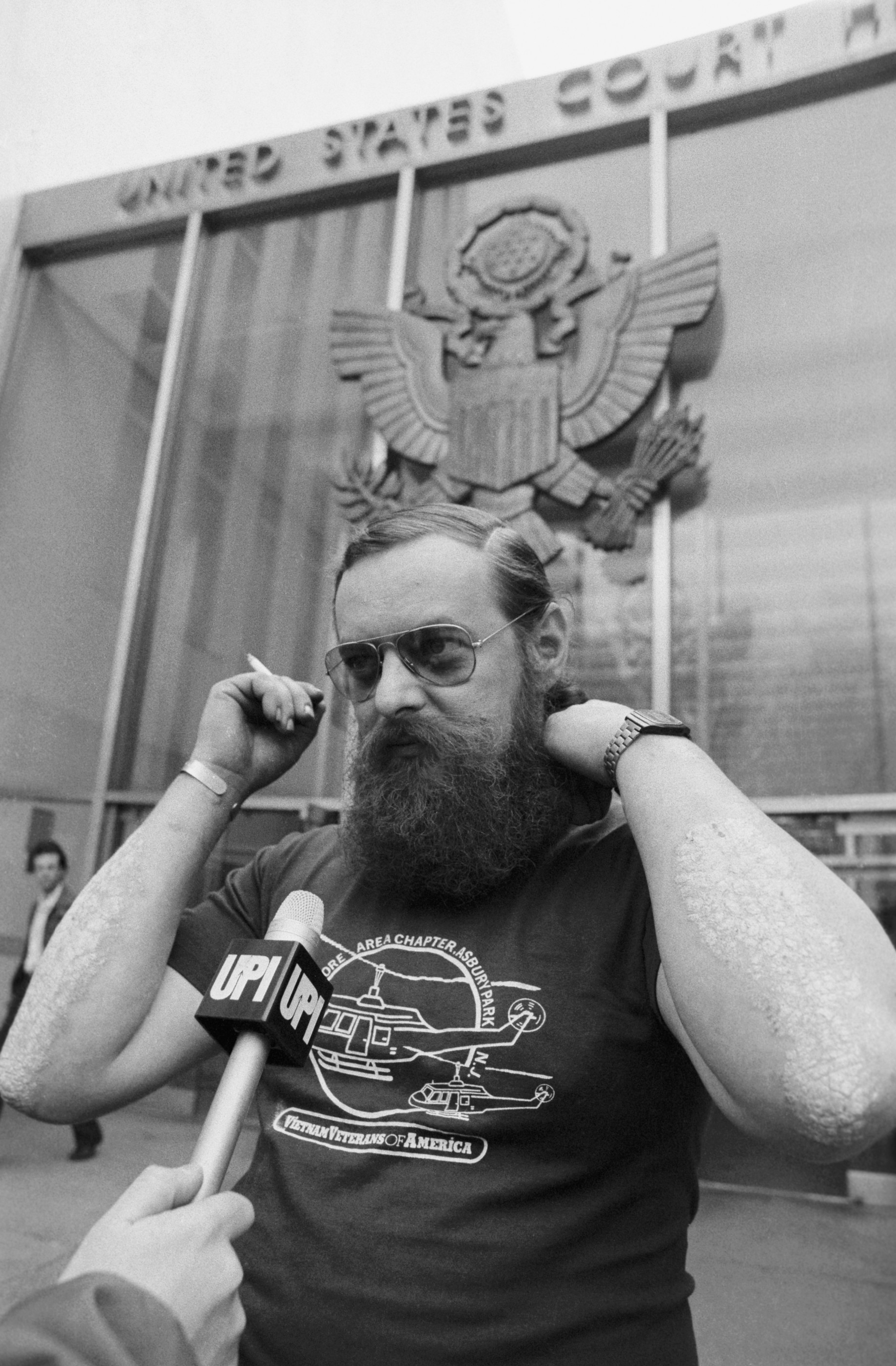 American veteran shows the long rashes across his arms that he
