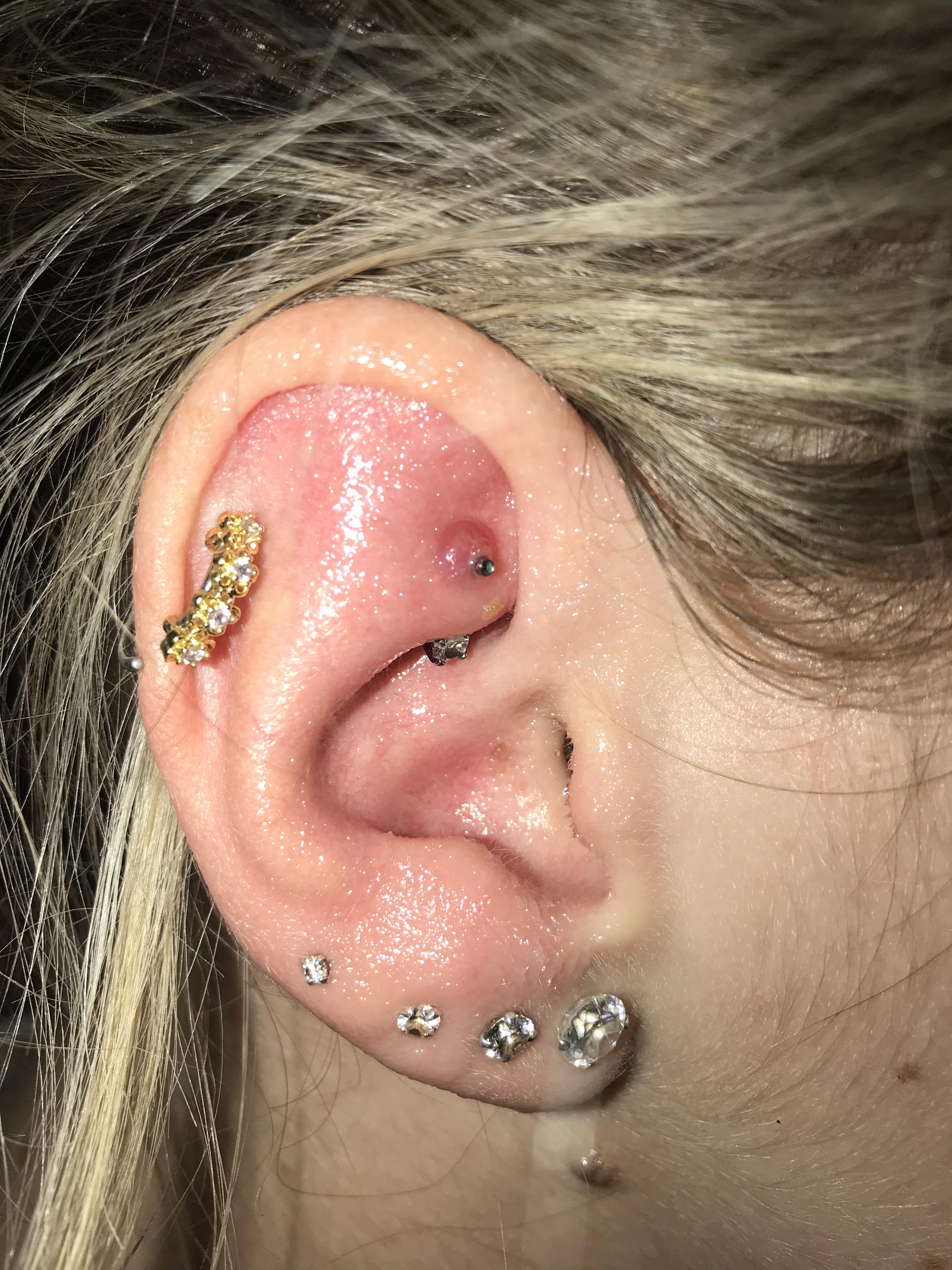 BIG piercing bump on Rook. Got the piercing 5 months ago. Have tried