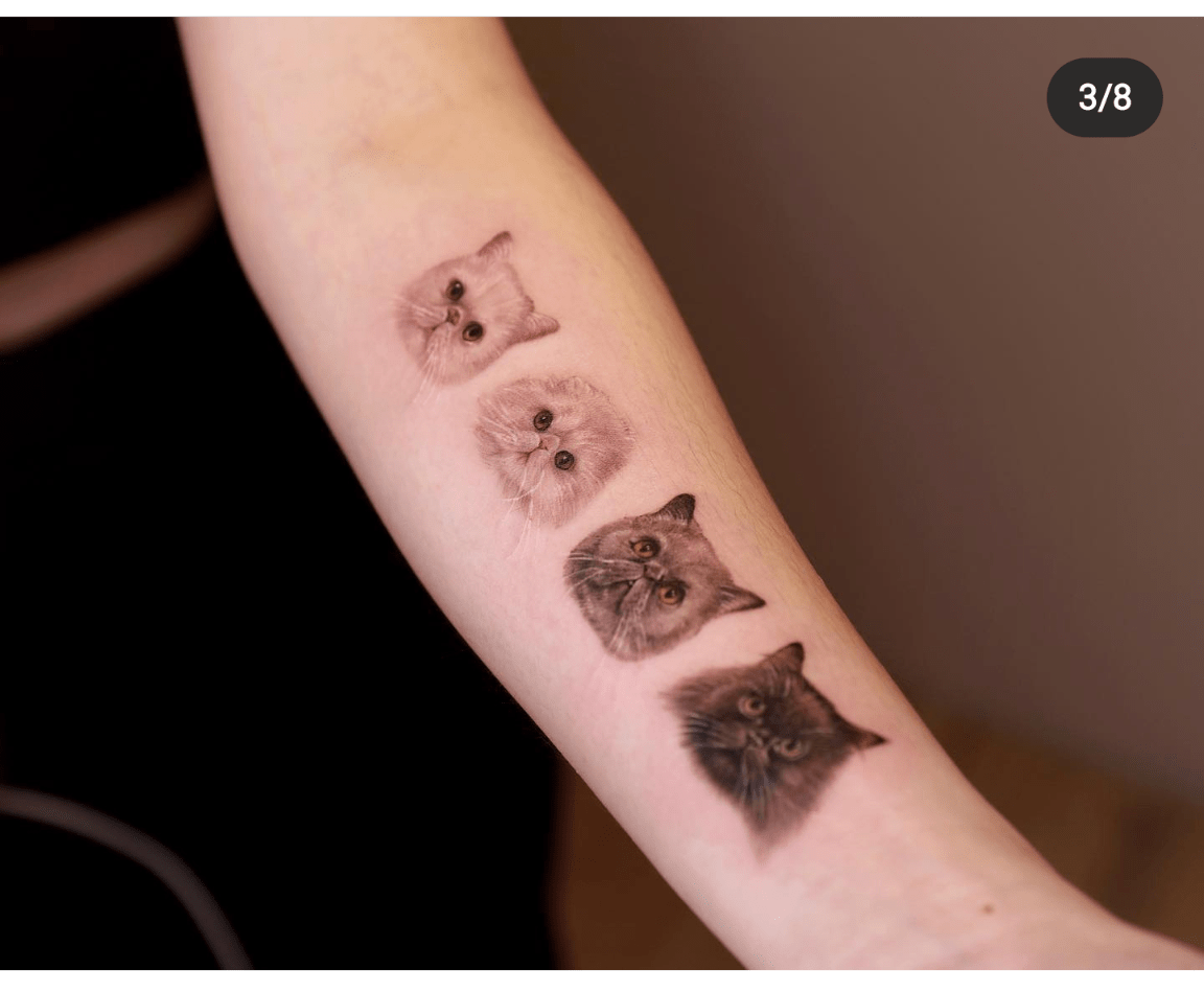 Tattoo Removal Edmonton Reddit QTATO