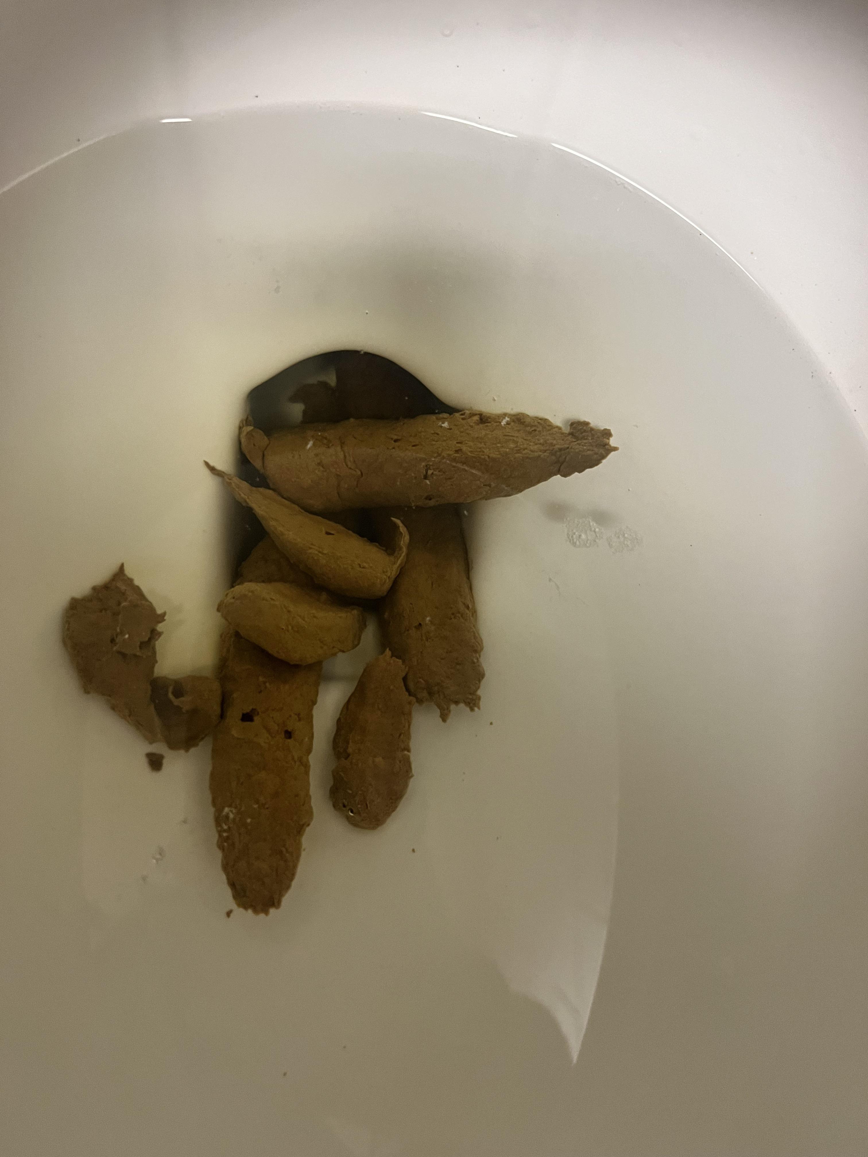 Ulcerative Colitis? colorectal Cancer? Does this look flat? My poops
