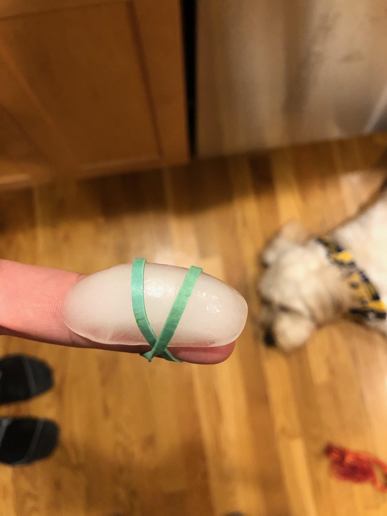 Replacing a bag of ice with a single cube for my burnt finger. (Dinner