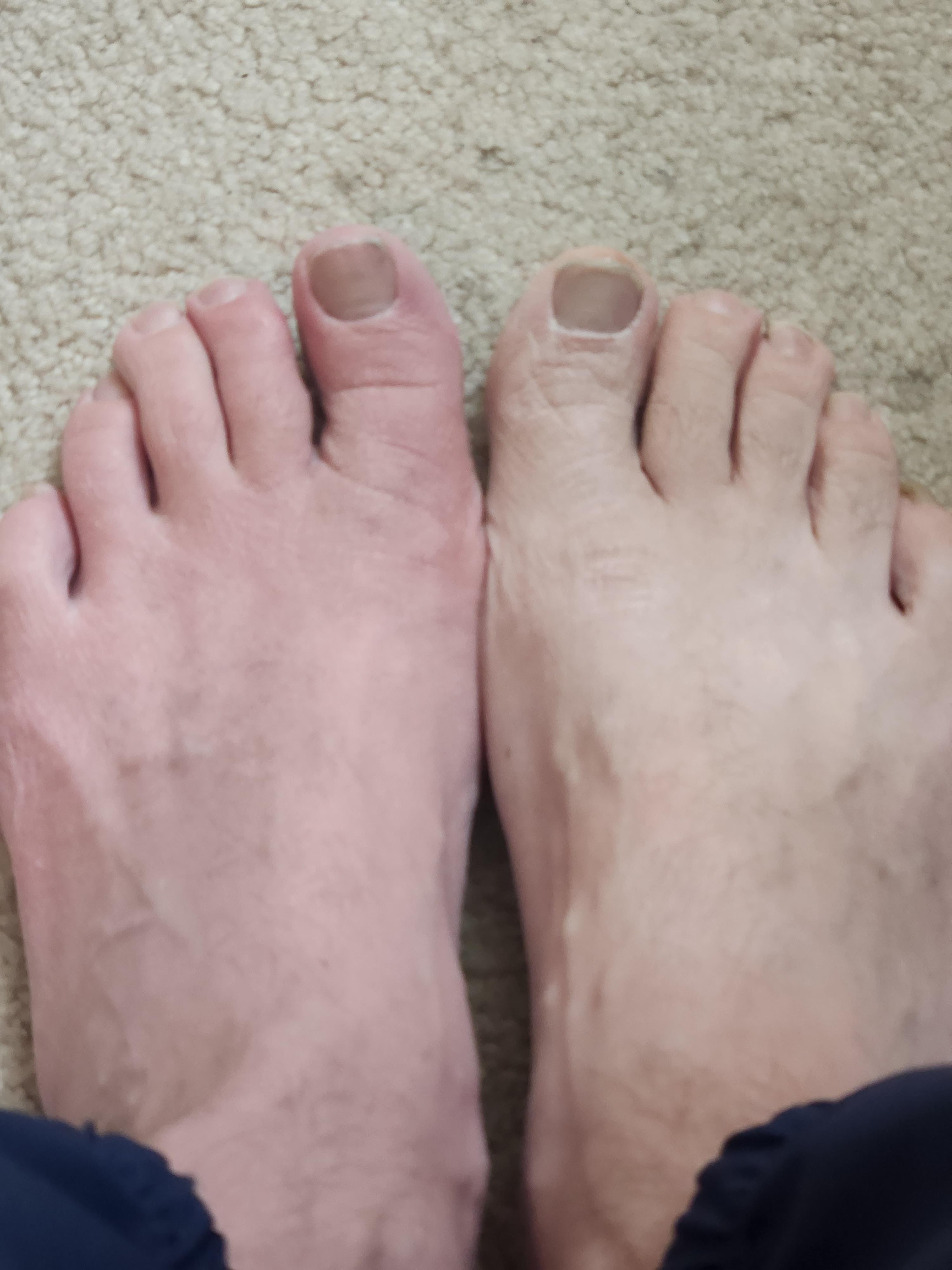 pain in calf when walking a bit. foot feels like it is being squeezed