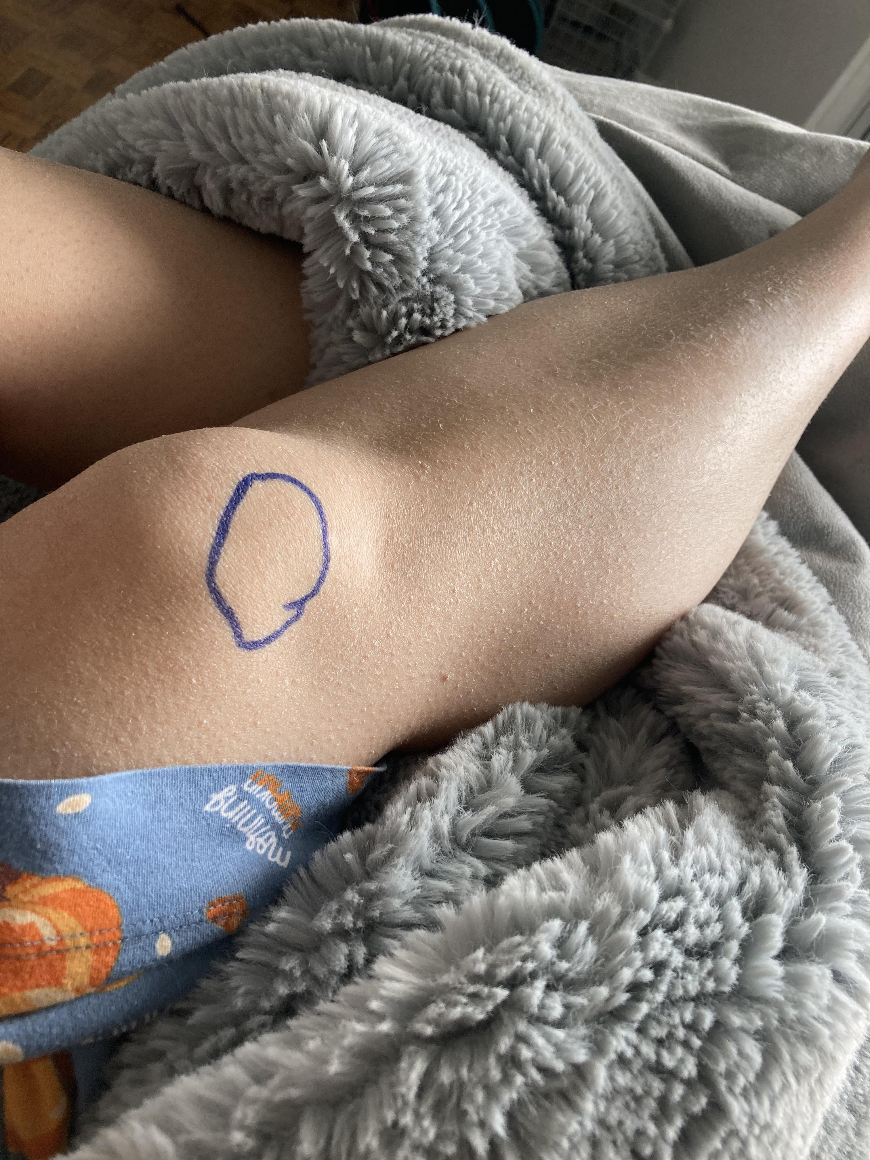 Sharp knee pain when touched or kneeling. Can walk with little issues