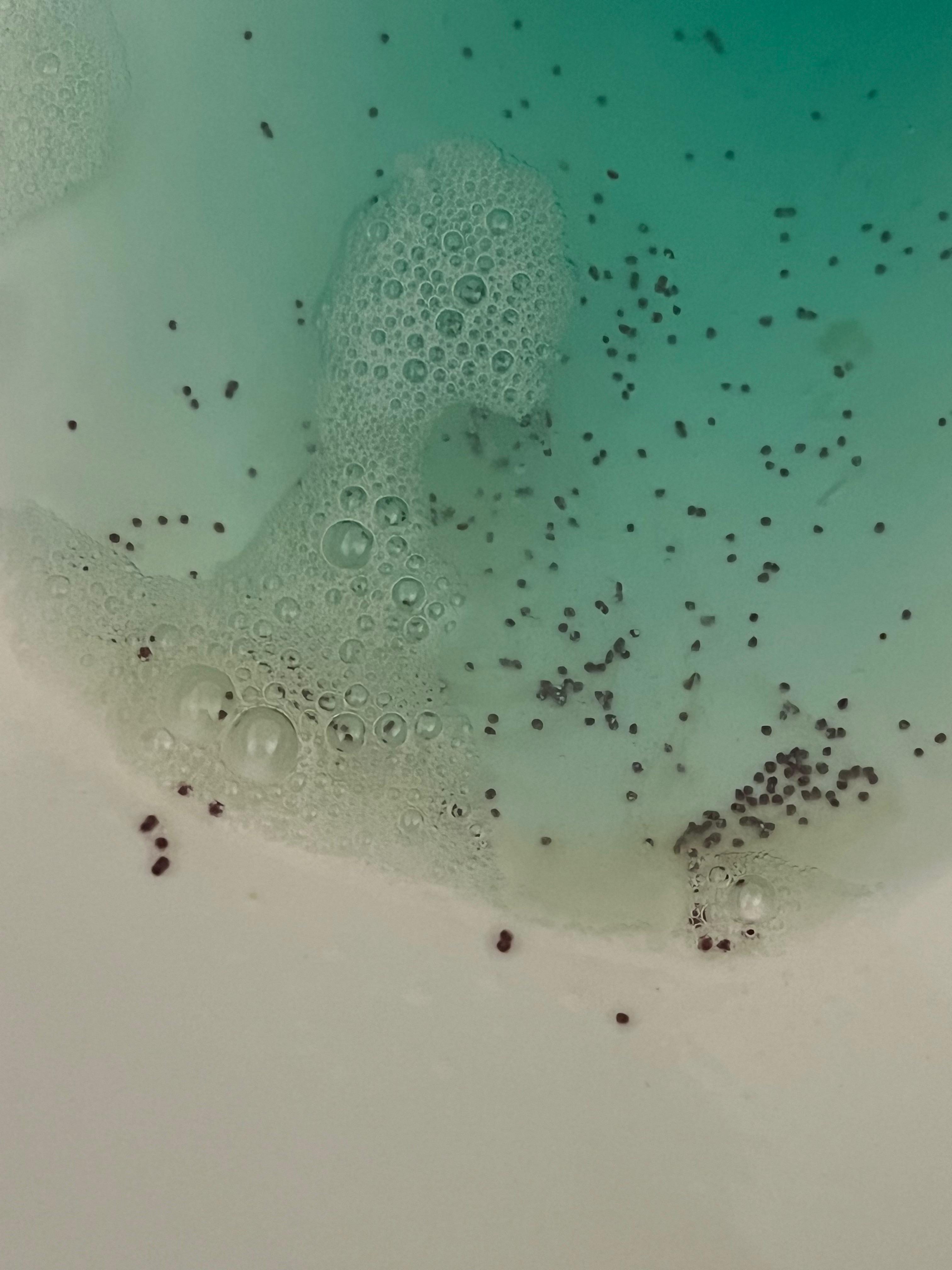 Brown specks in vomit with alcohol induced gastritis. No food in system any idea what that is