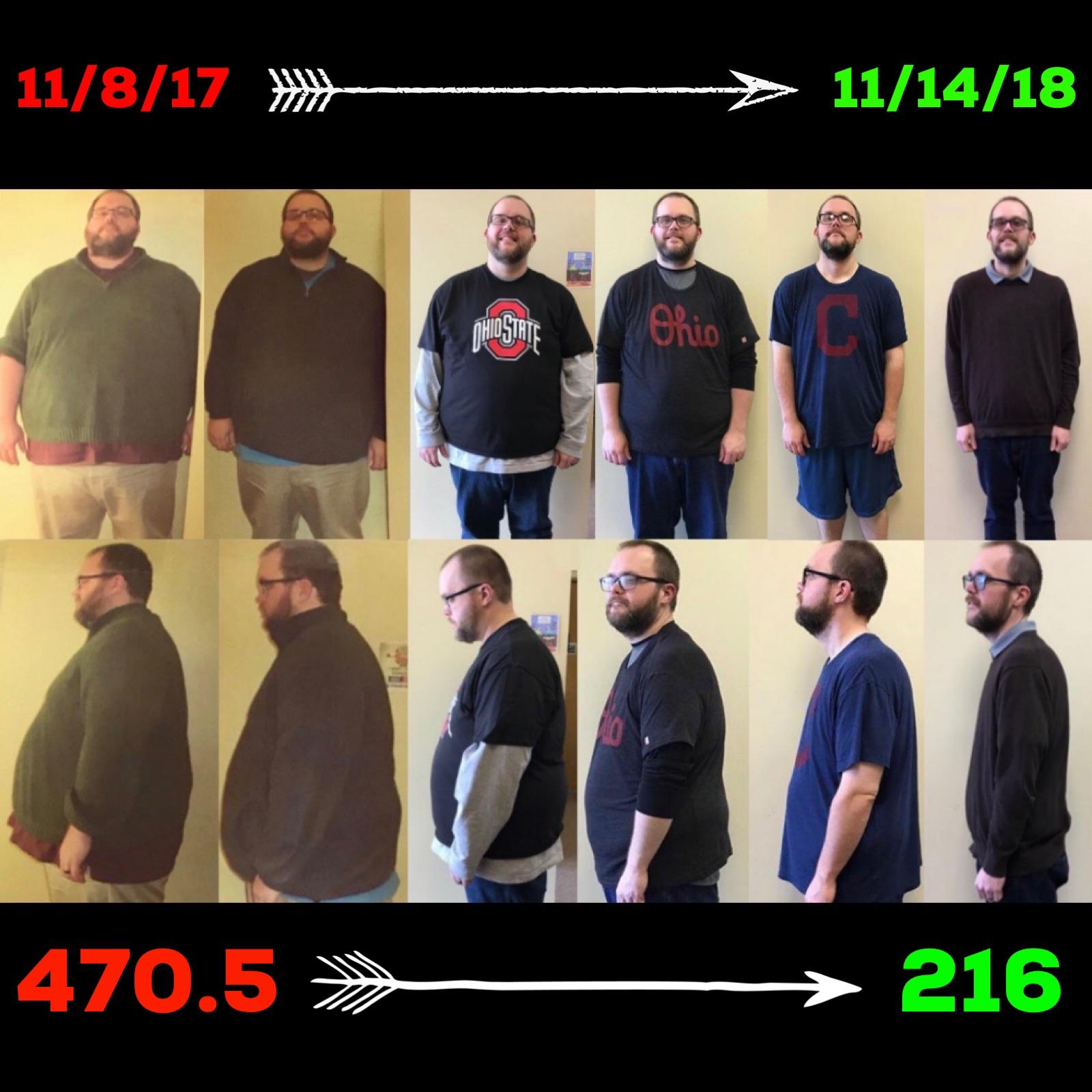 M/34/6’2” [470.5 pounds > 216 pounds = 254.5 pounds lost] (53 weeks