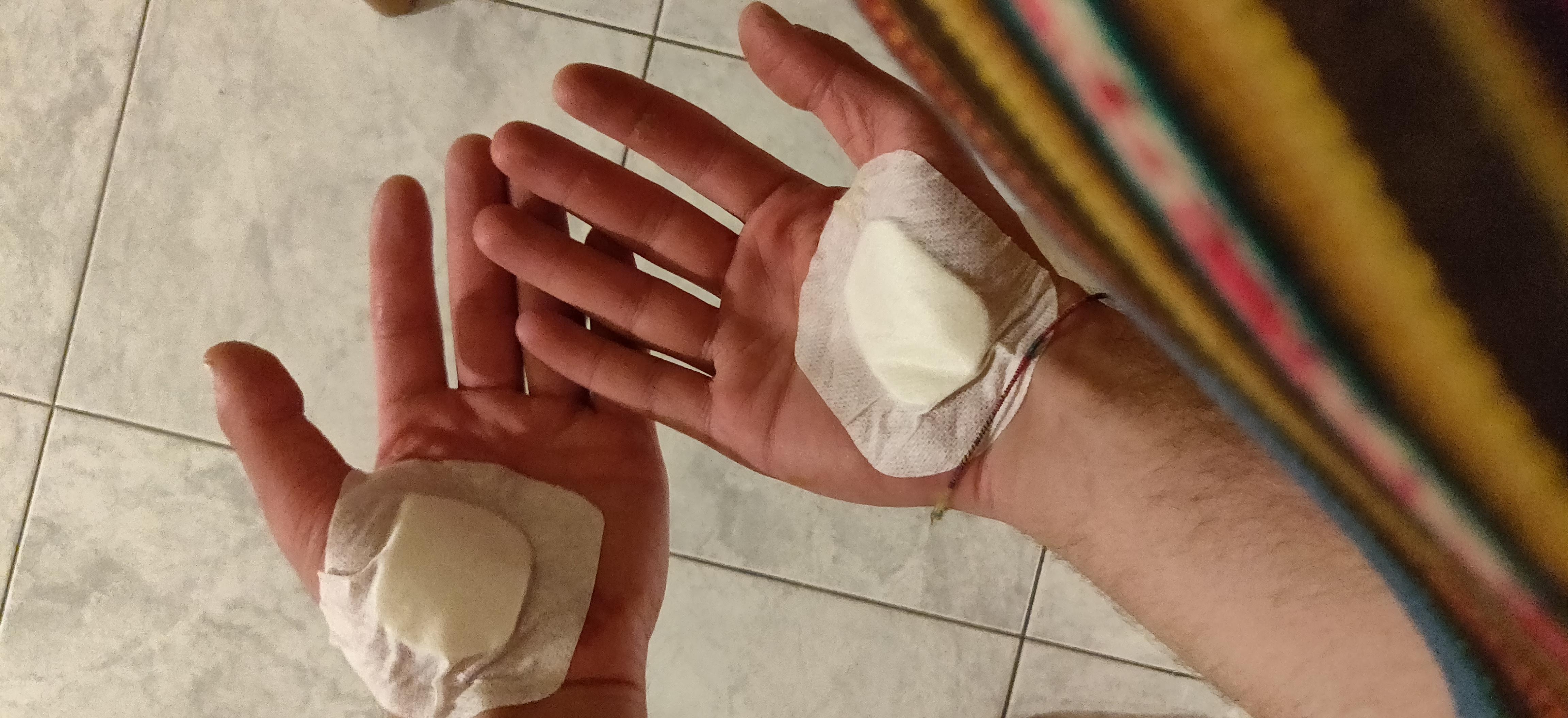 ALWAYS wear gloves. r/onewheel