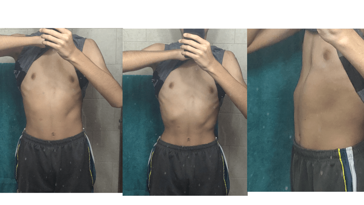 I'm not sure if I have PE or not. I'm 16, Underweight (120lbs) and