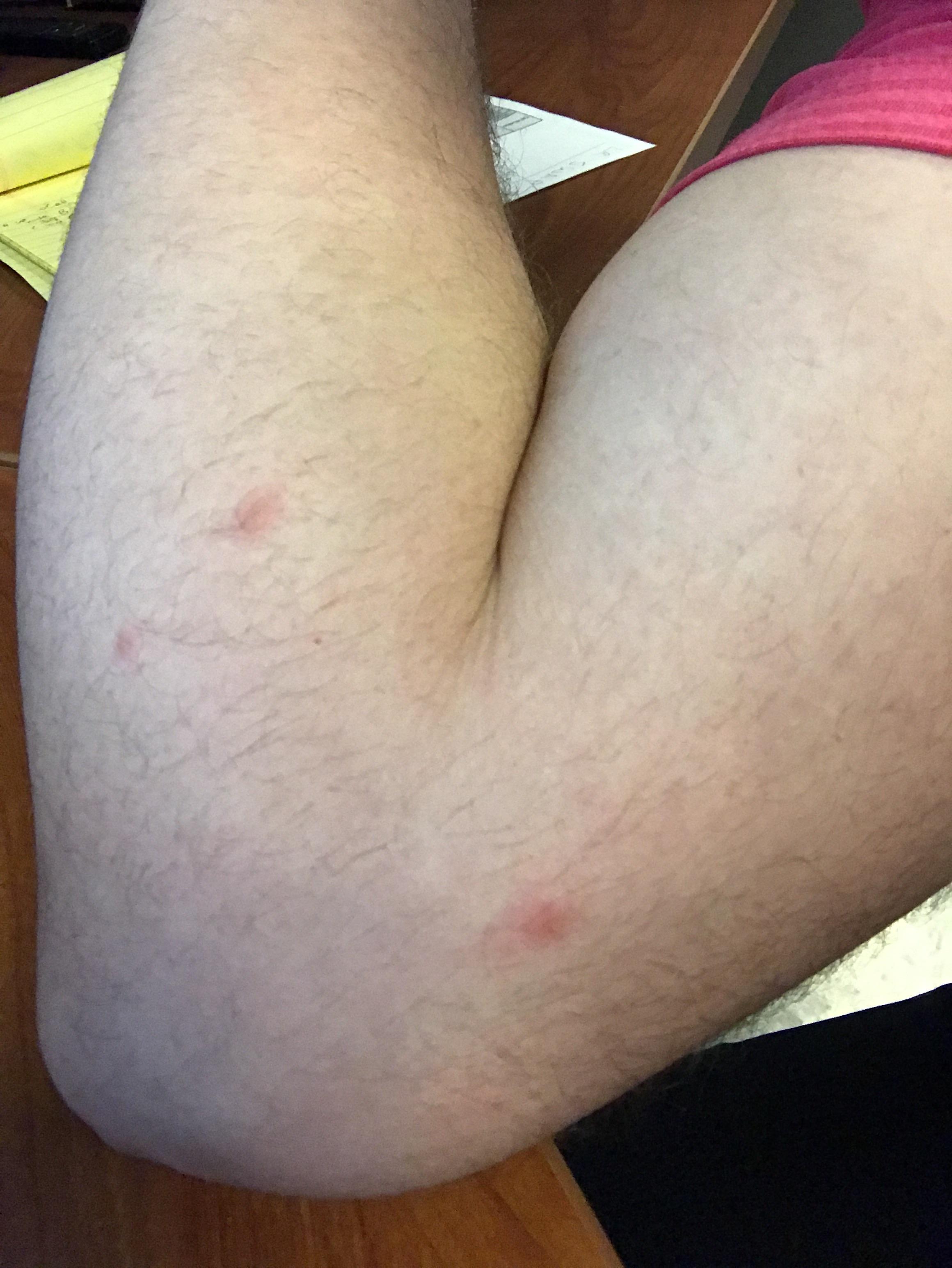 This is driving us crazy.. I only have these few bites