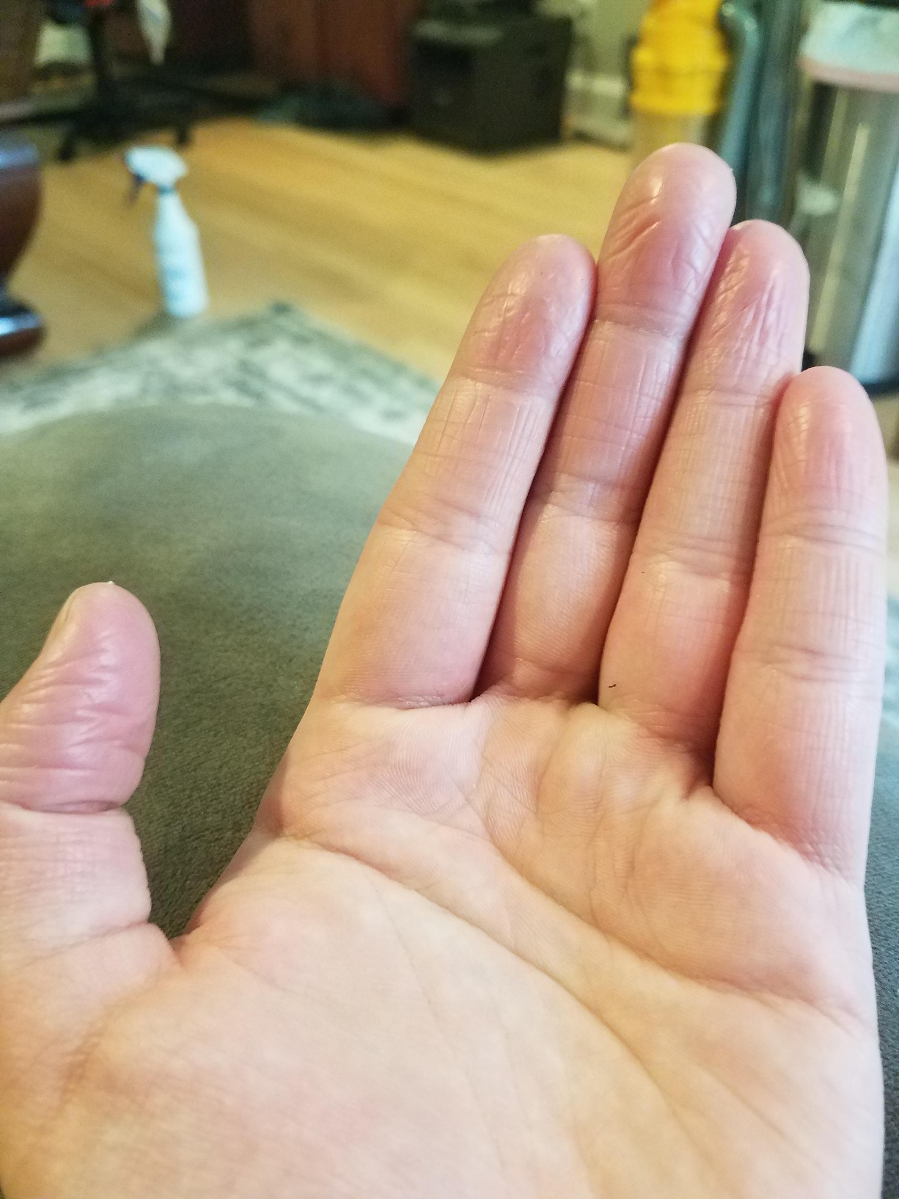 I don't have fingerprints. r/mildlyinteresting
