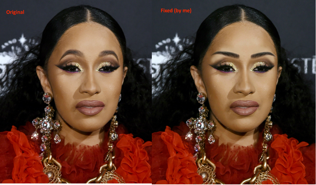 [Download 31+] 42+ Cardi B Before Her Teeth Fixed