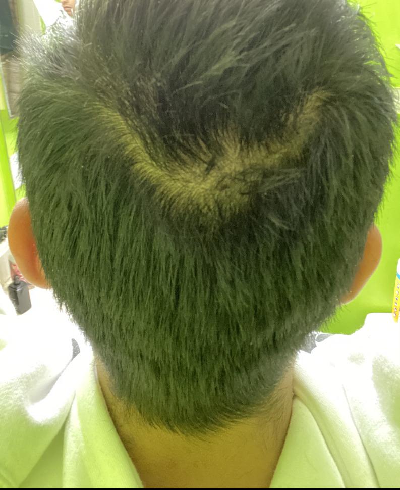 how can i fix this weird part in my hair? my doctor said it doesnt