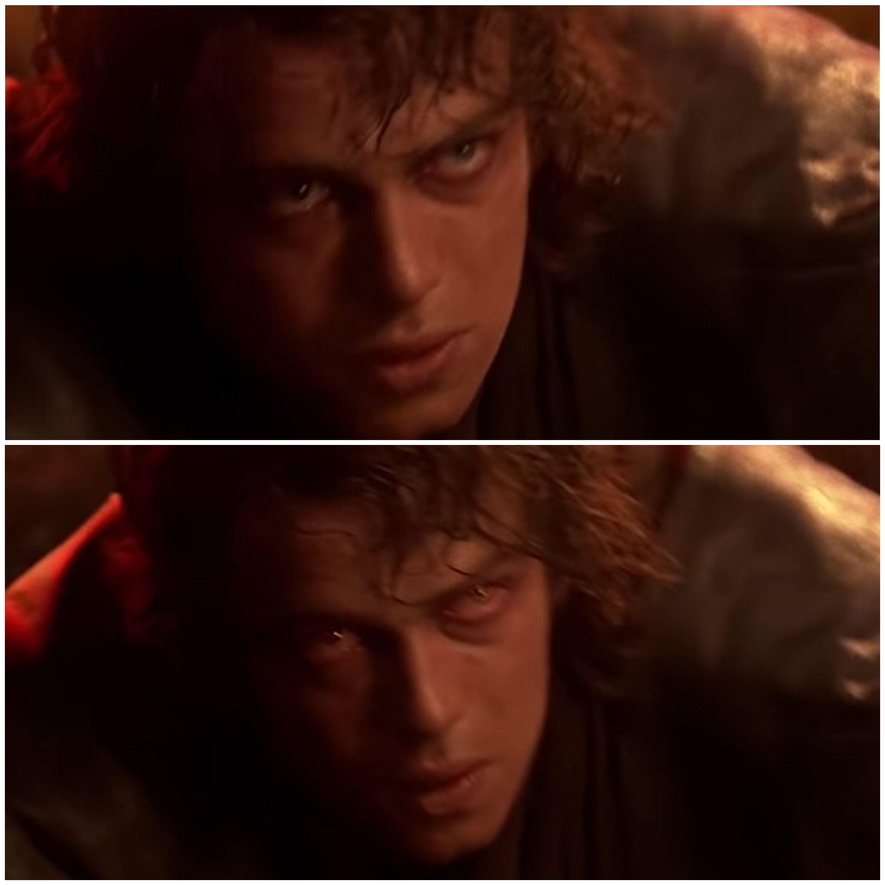 Anakin Episode 3 Dark Side