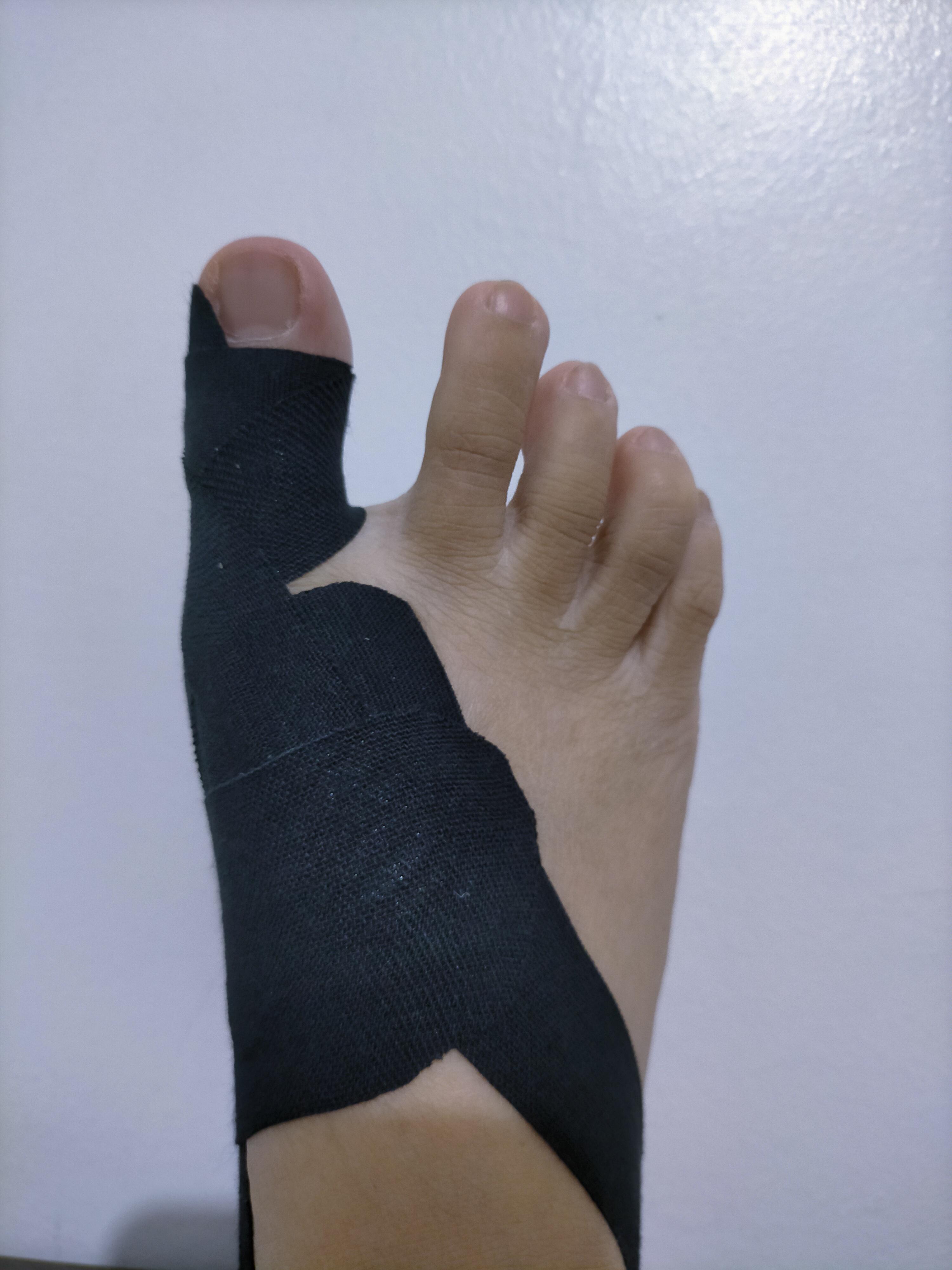 My toes often feel 'tight' because of my bunion but I've discovered