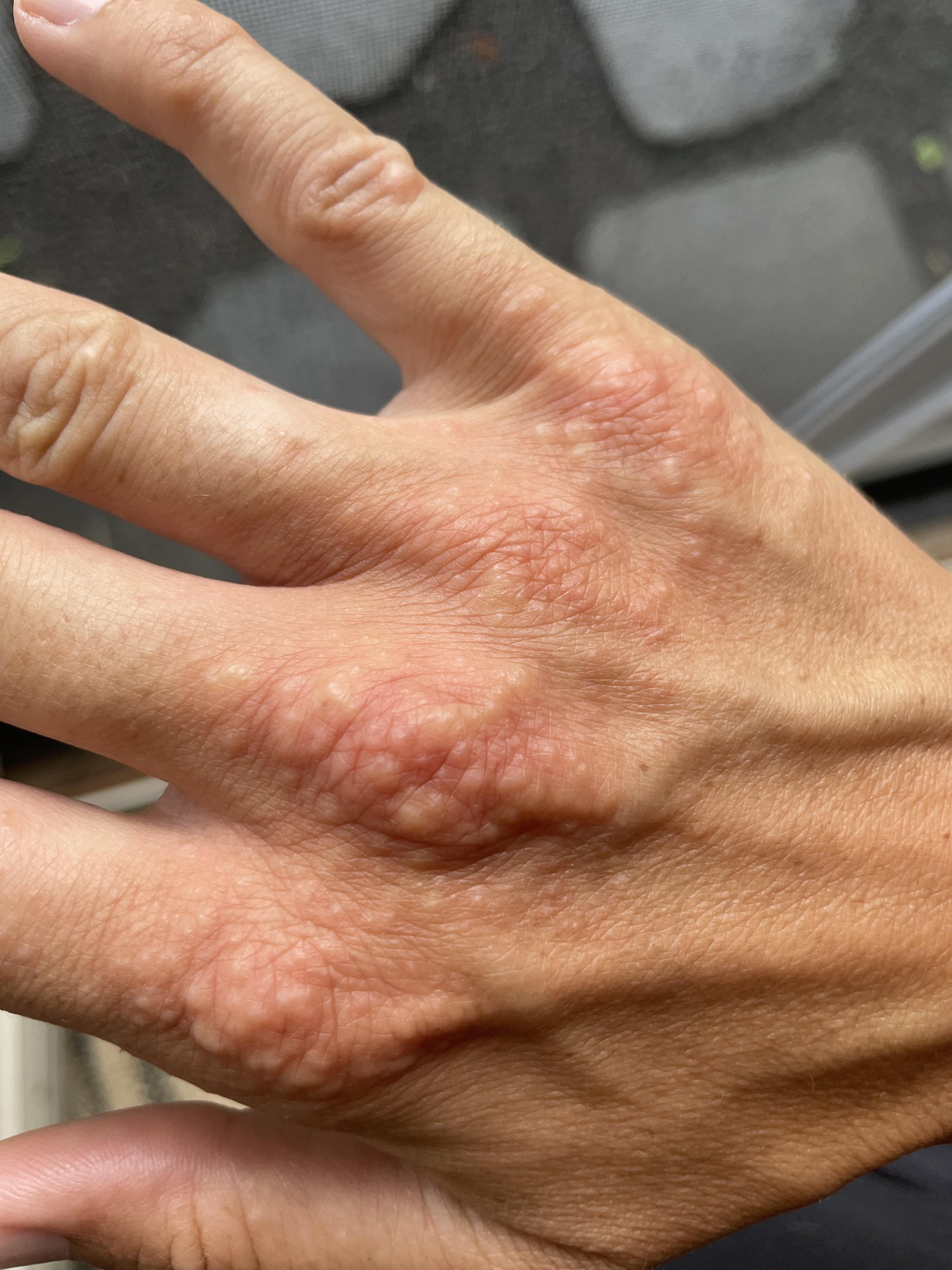 Any idea what this is? Just suddenly appeared on my quad