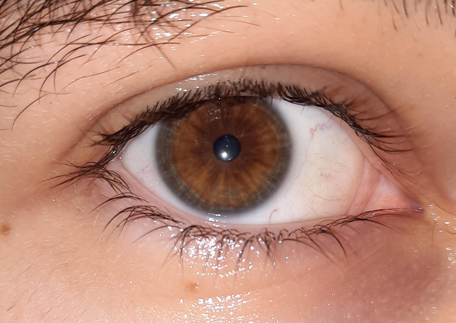 Always thought I had brown eyes until I noticed this gray ring a couple