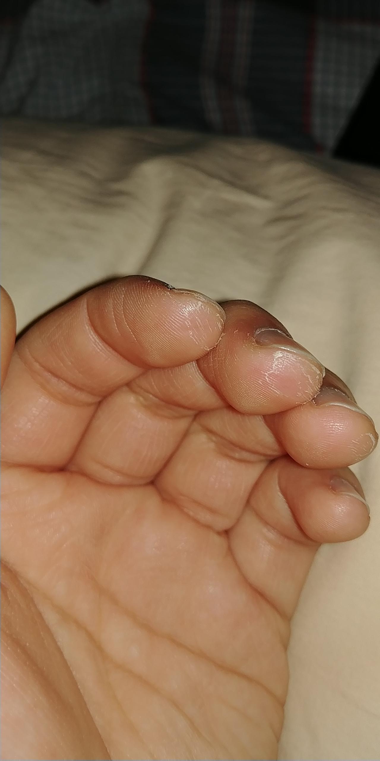 Is been 3 weeks of playing ukulele. My finger tips are now numb but