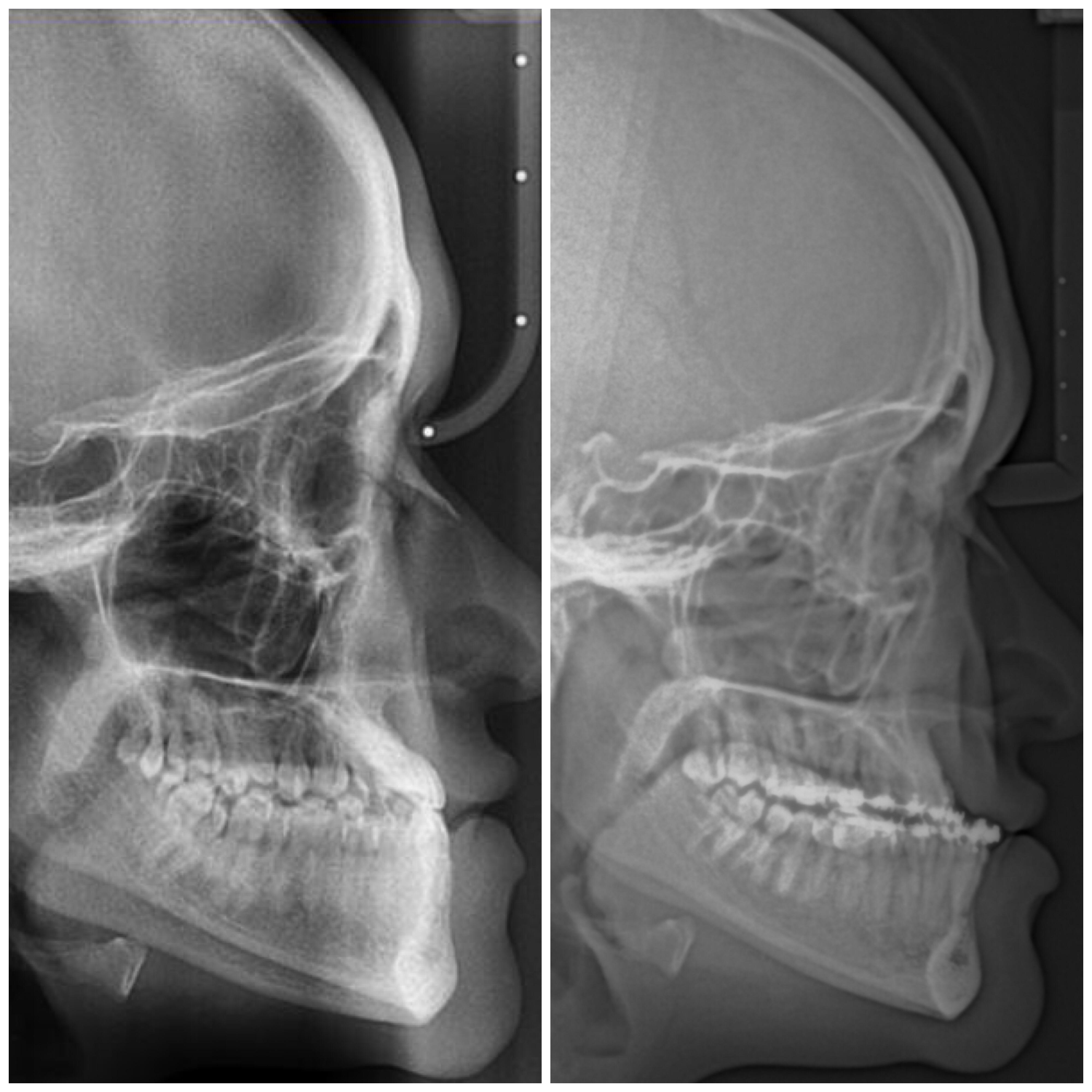 Hi guys, hope you’re all doing well and keeping safe ). These are my