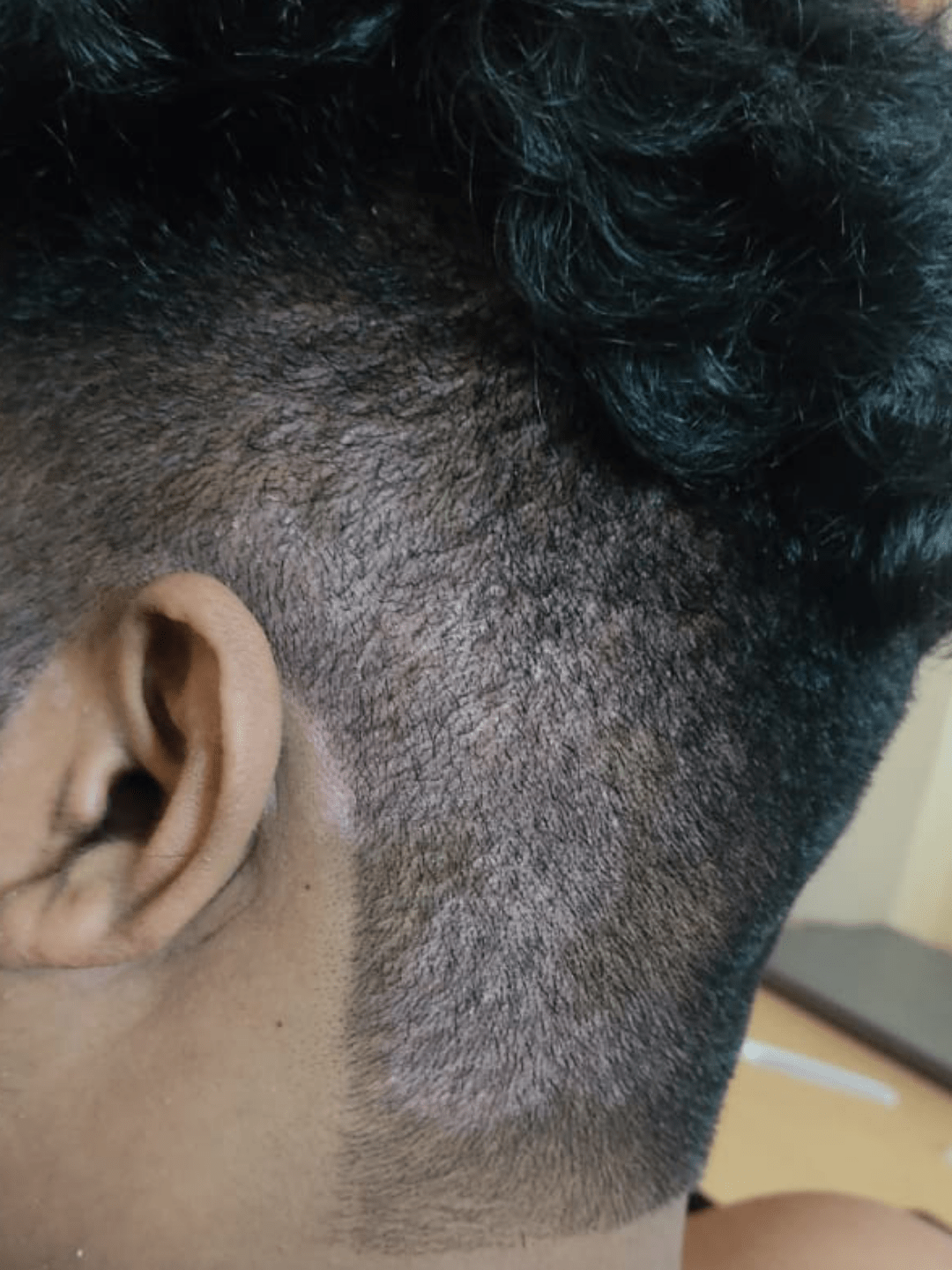 Help needed to identify this? Thought this is dandruff. Noticed this