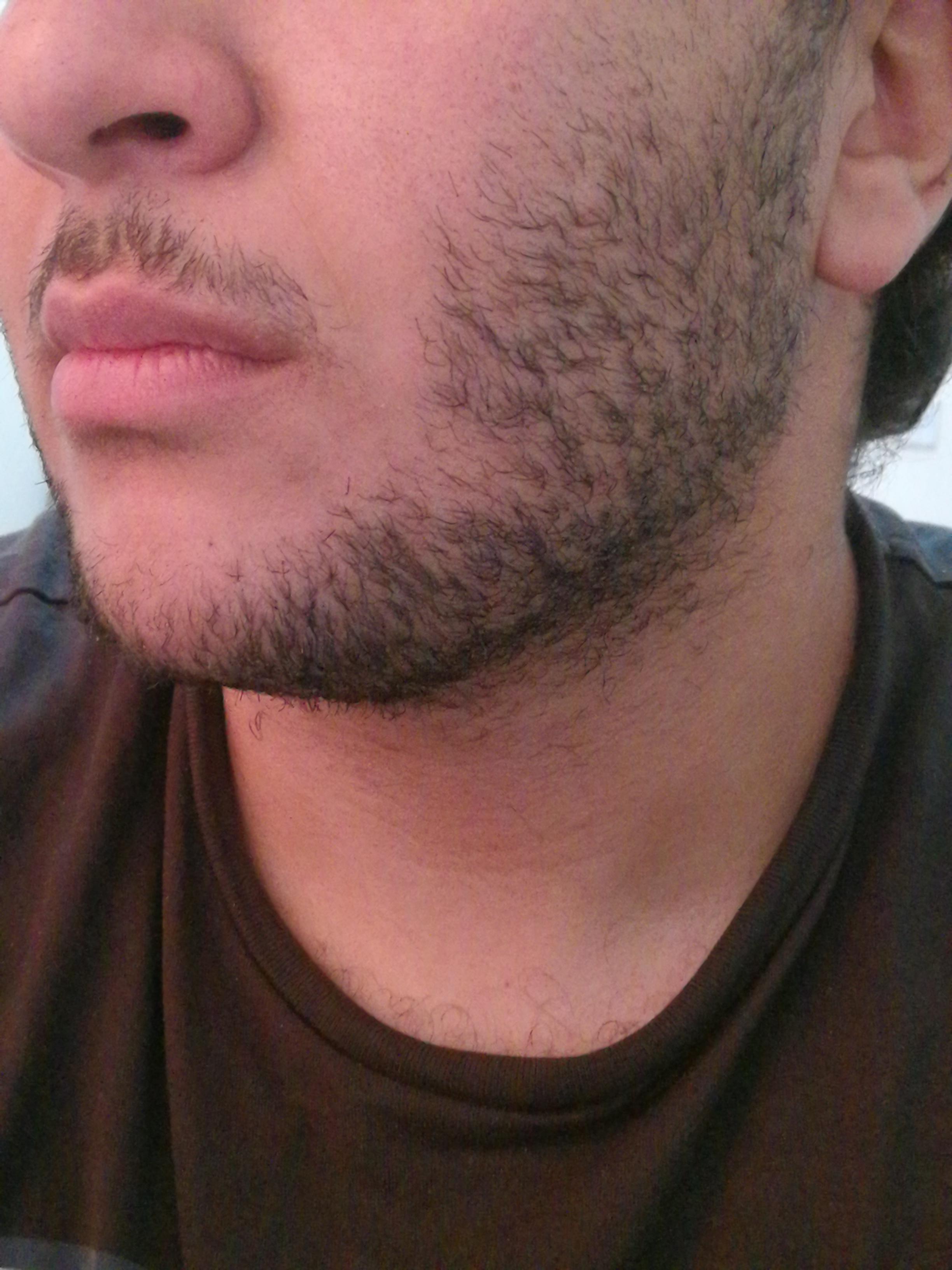 1 month of my beard and it's gross.. Any advice.. r/BeardAdvice