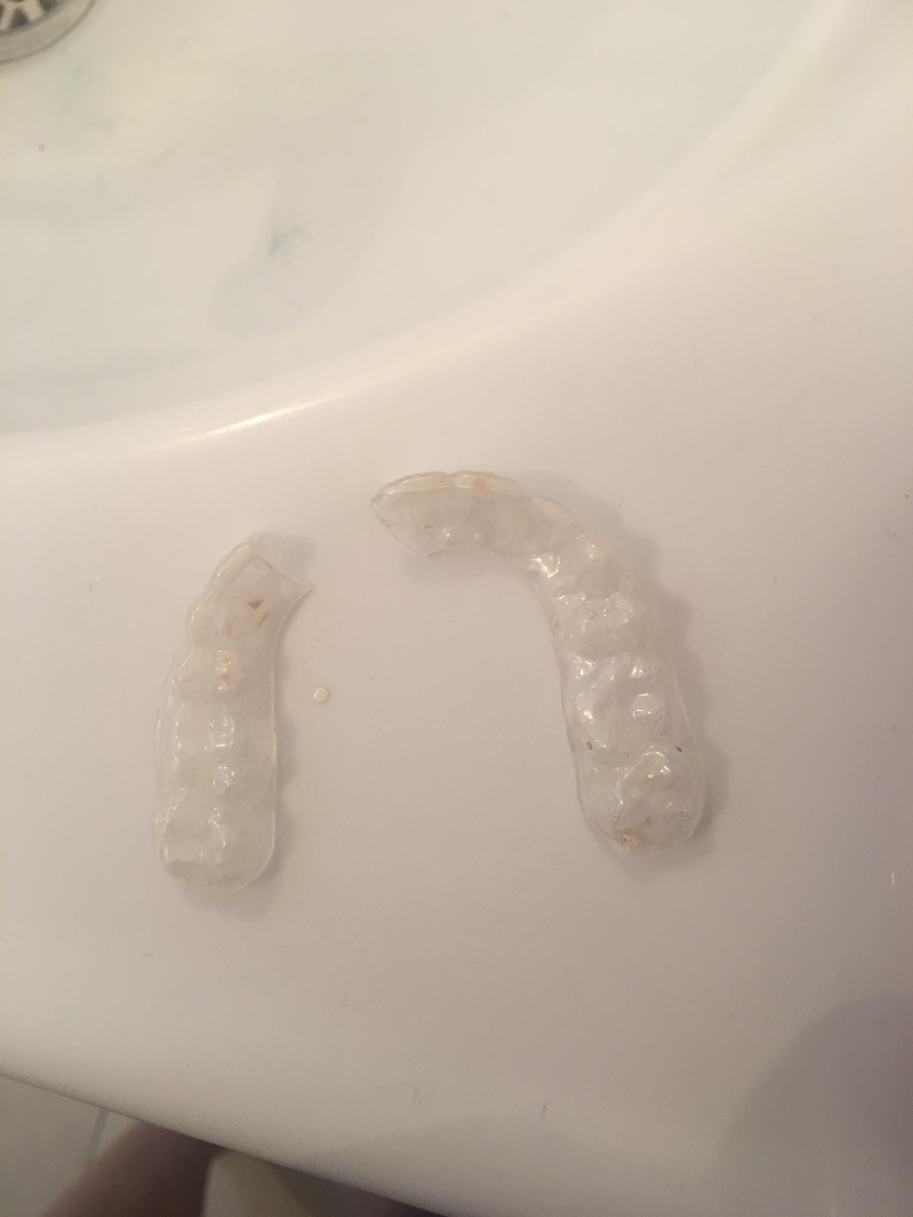 I broke my retainer last night (invisilign) and I’ve only had them for