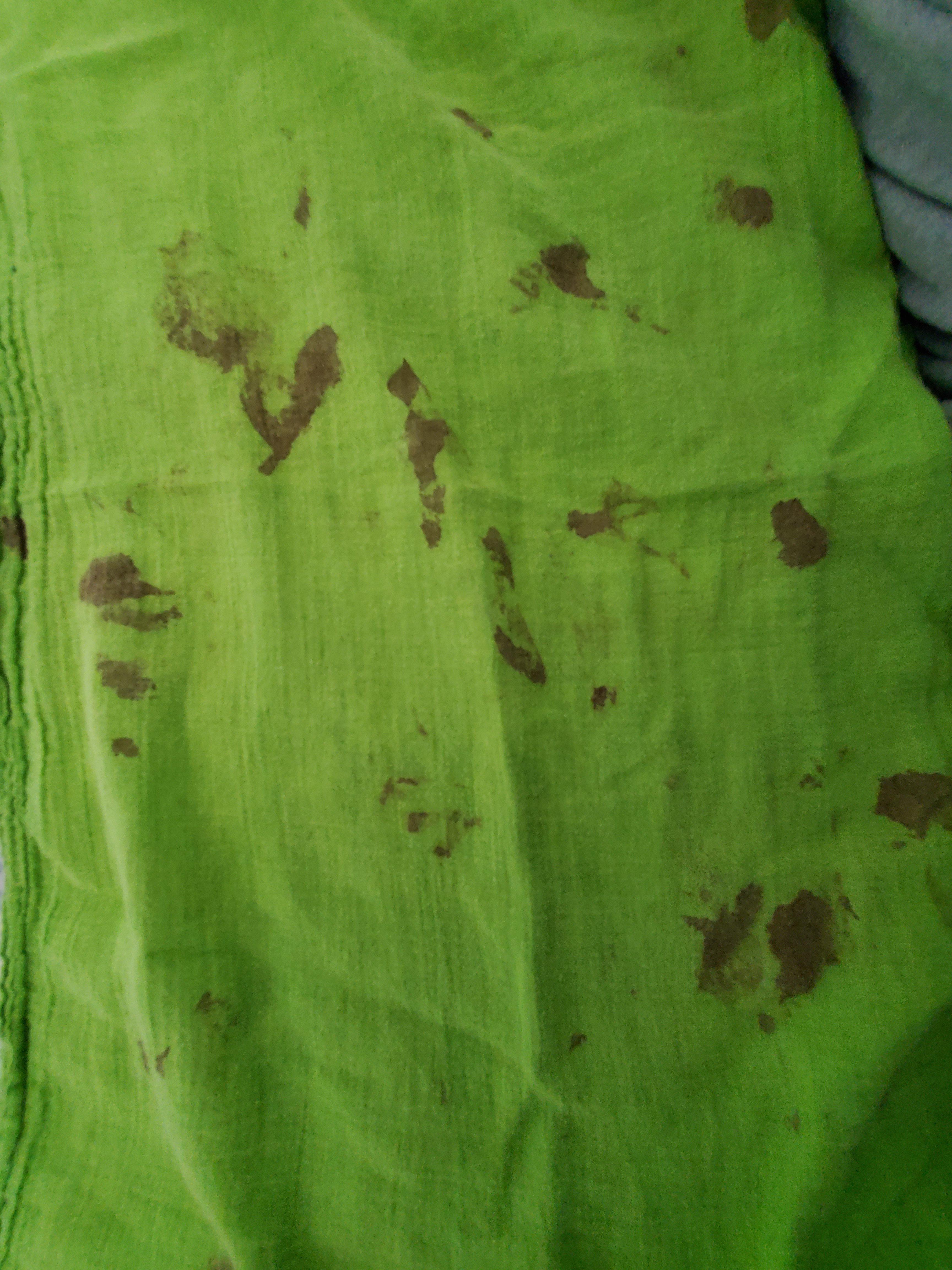 Could someone help me how to remove blood stains from cloth? I use tide