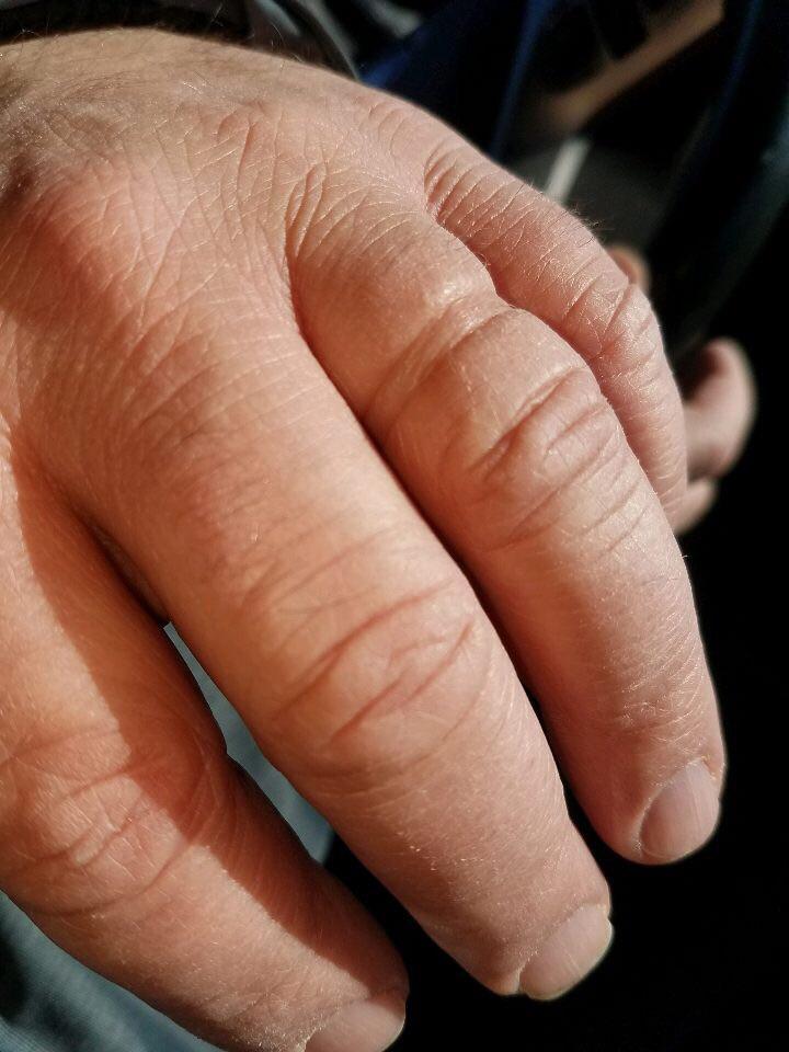 The mark left over after my father took off his wedding ring for the