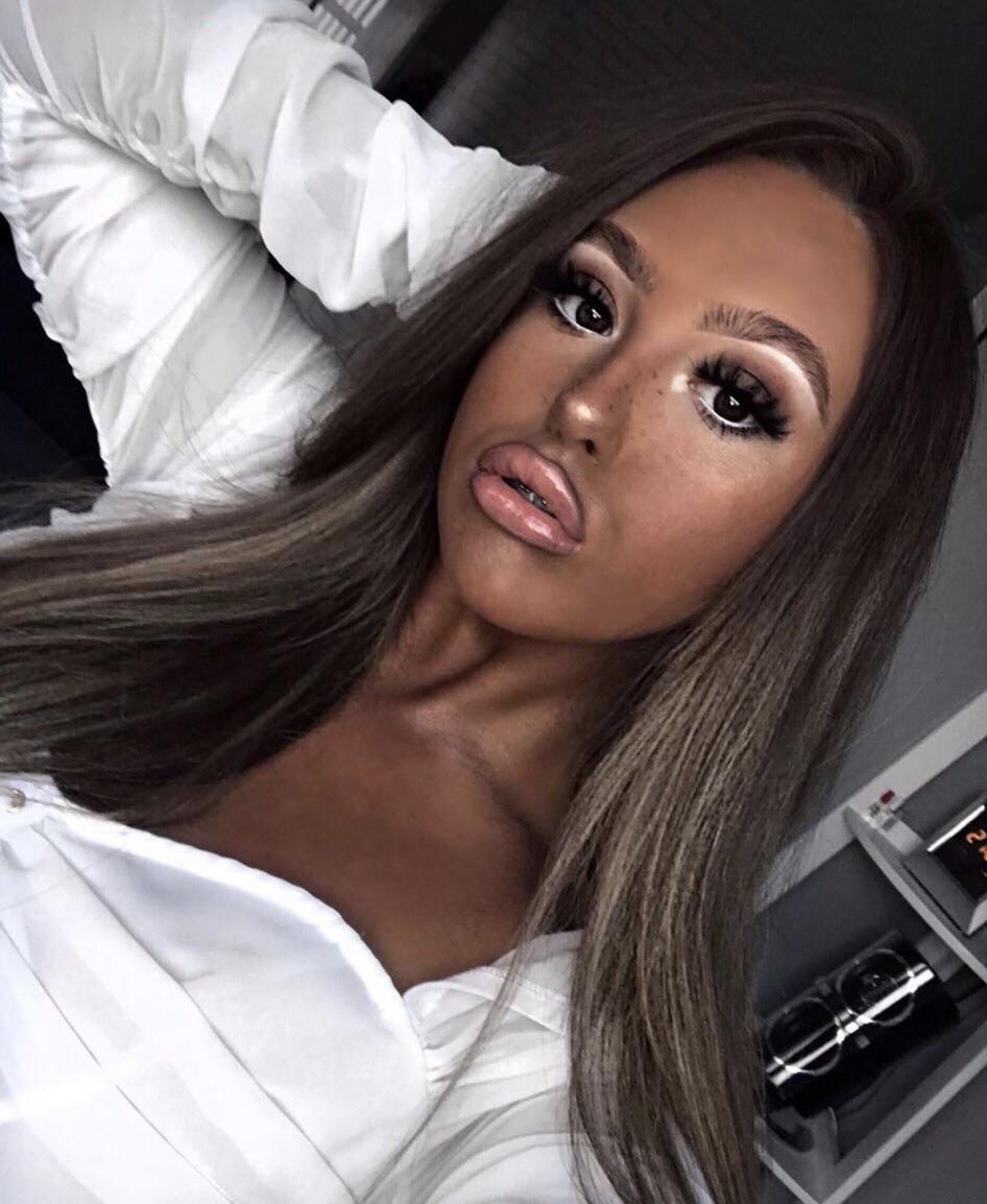 The over drawn lips...the super dark tan....HER NECK YALL. r/blackfishing