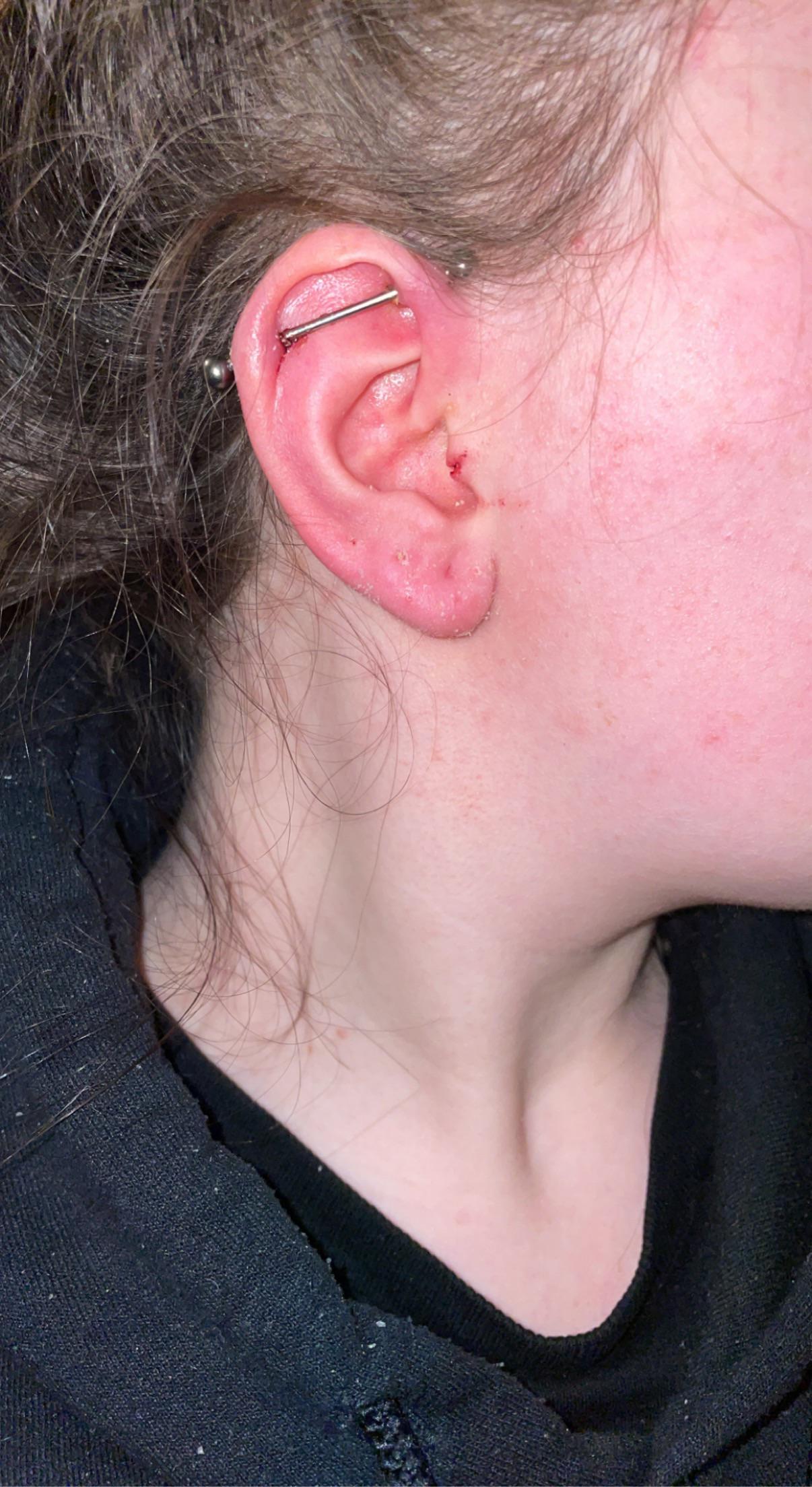 Tragus piercing rejected, what do I do? (It’s 2 years old and I didn’t