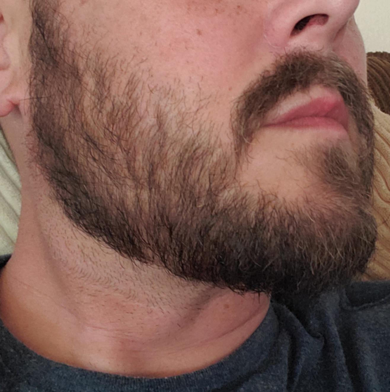 Now what ) I've been growing and lining this for a couple months. I