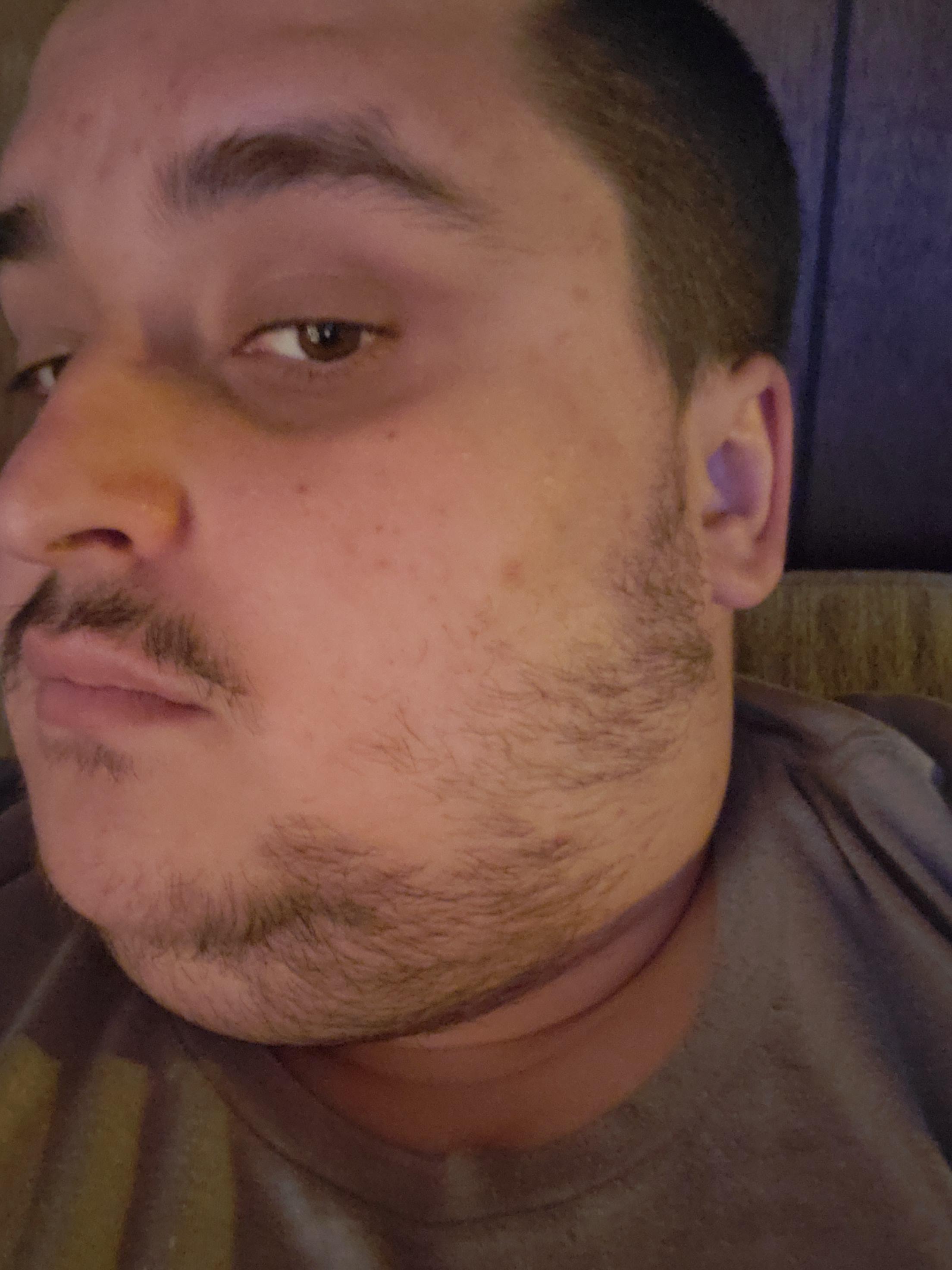 1 month in. I'm 26 and in the first time in my adult life I can have facial hair at work. Idk