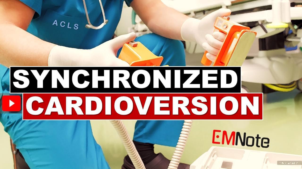 Synchronized cardioversion how to perform? r/FOAMed911