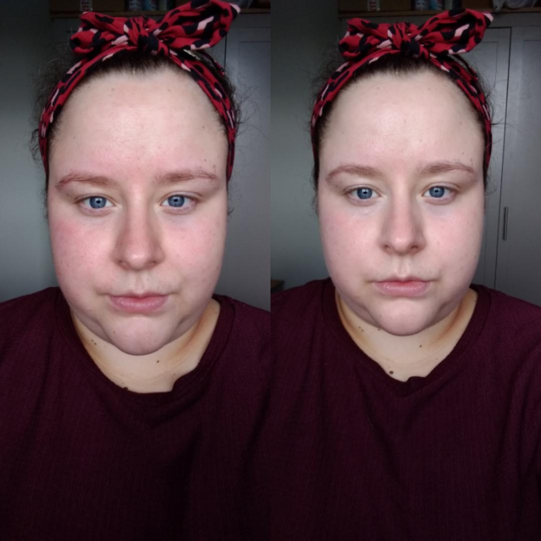 For people asking how much coverage skin tint gives. Left completely