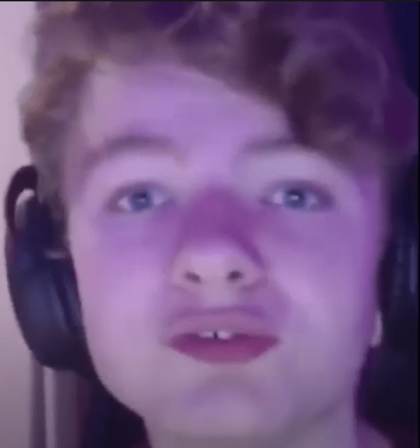 Those braces really did work well, Lmao r/tommyinnit