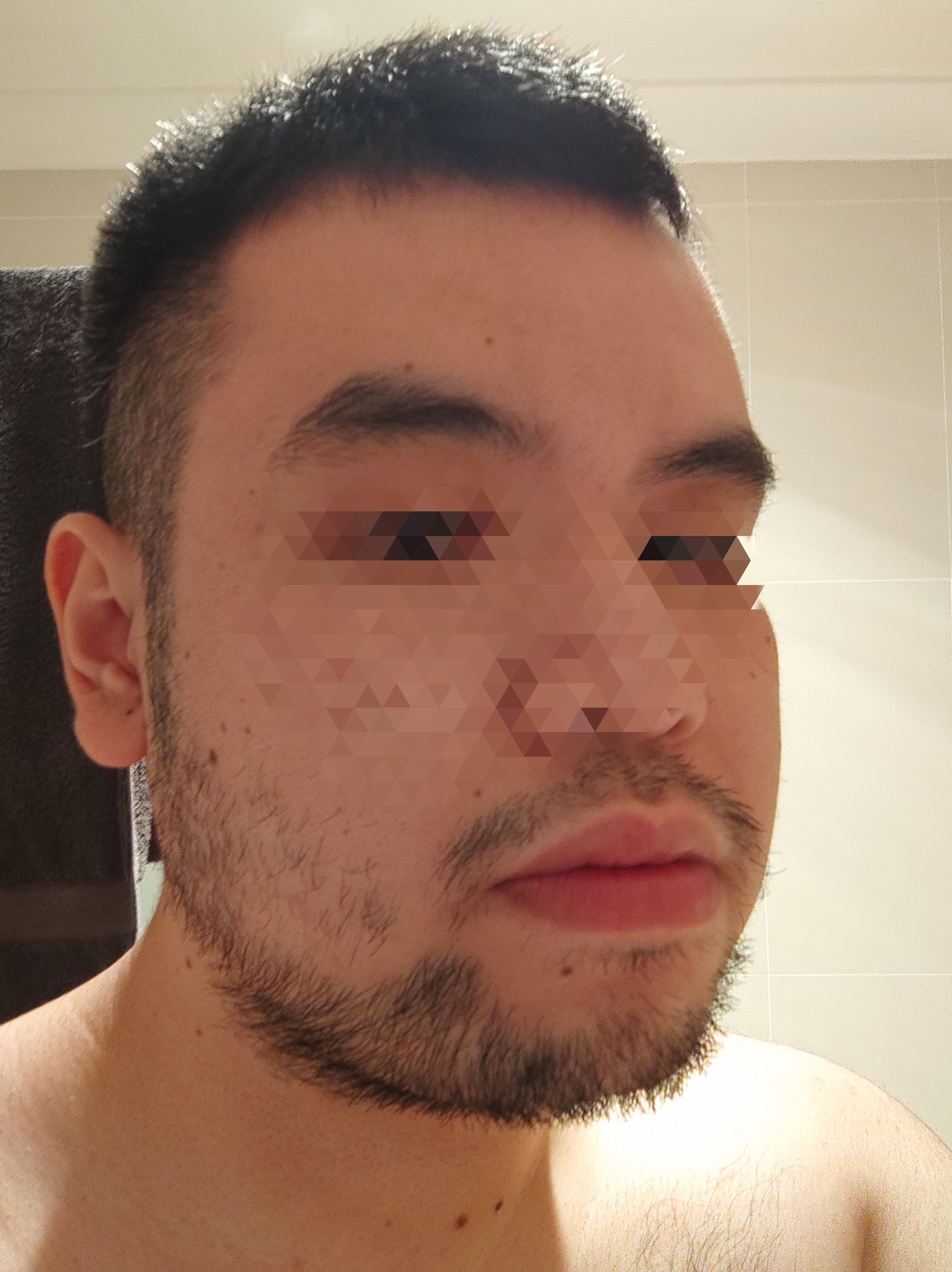 Should I shave my facial hair? 10 days of growth. r/malegrooming