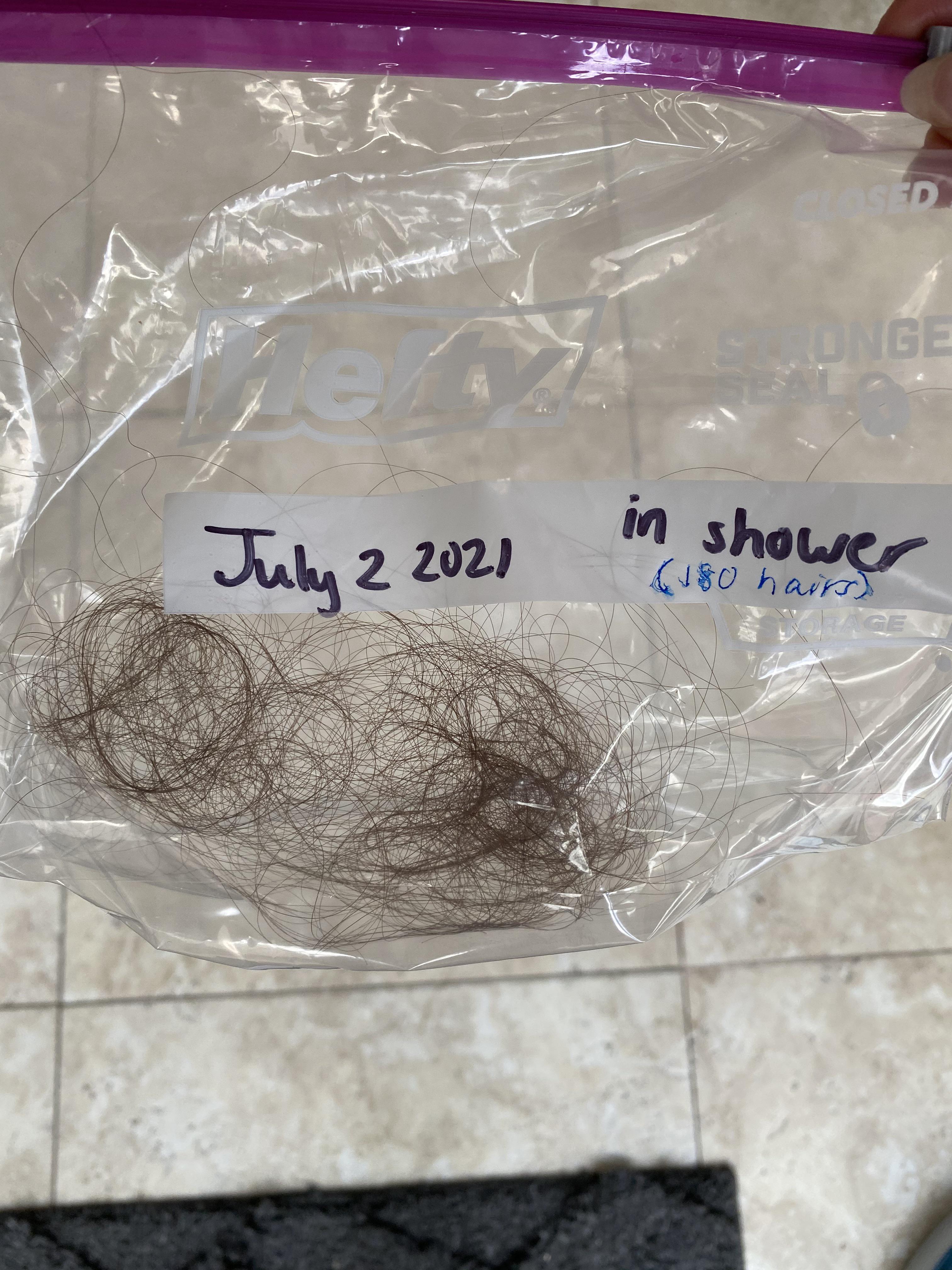 Is this a normal amount of hair to lose after 3 days of not washing? I