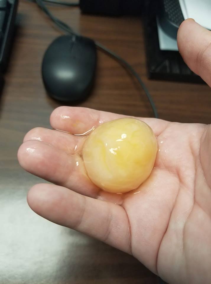 A weird egg yolk from work r/WeirdEggs