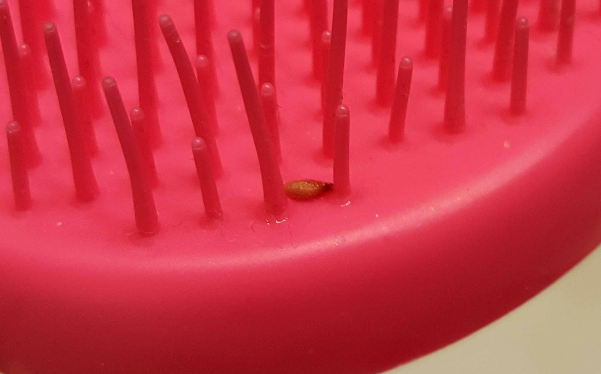 What is this on my daughter's hair brush? Been told it's not lice r