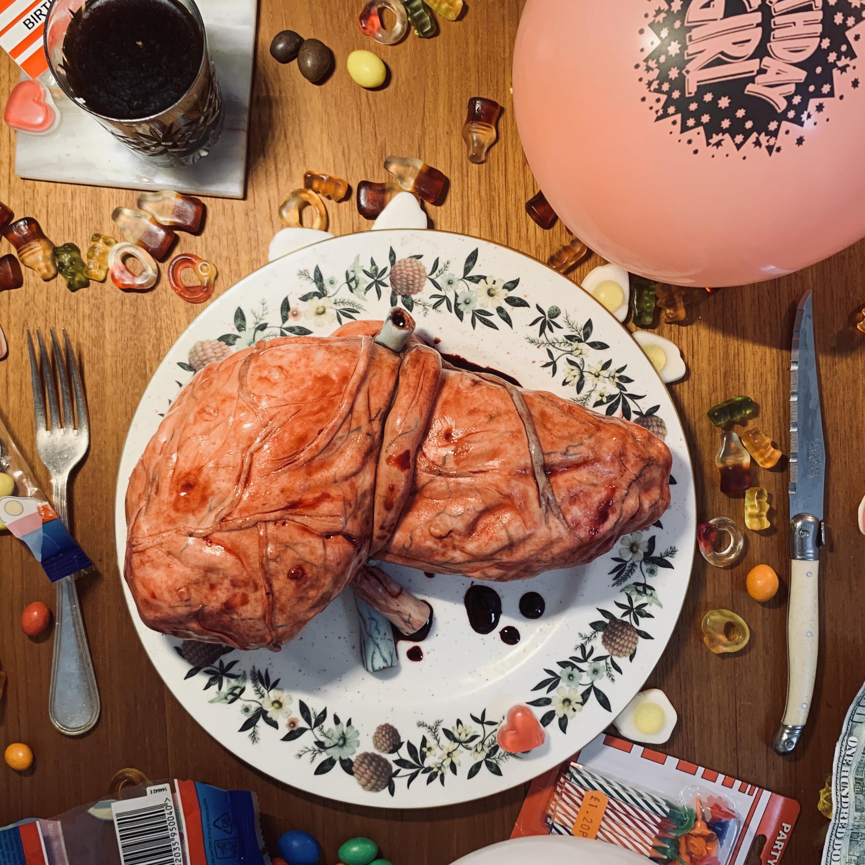 21 years ago my sister had a lifesaving transplant this year to