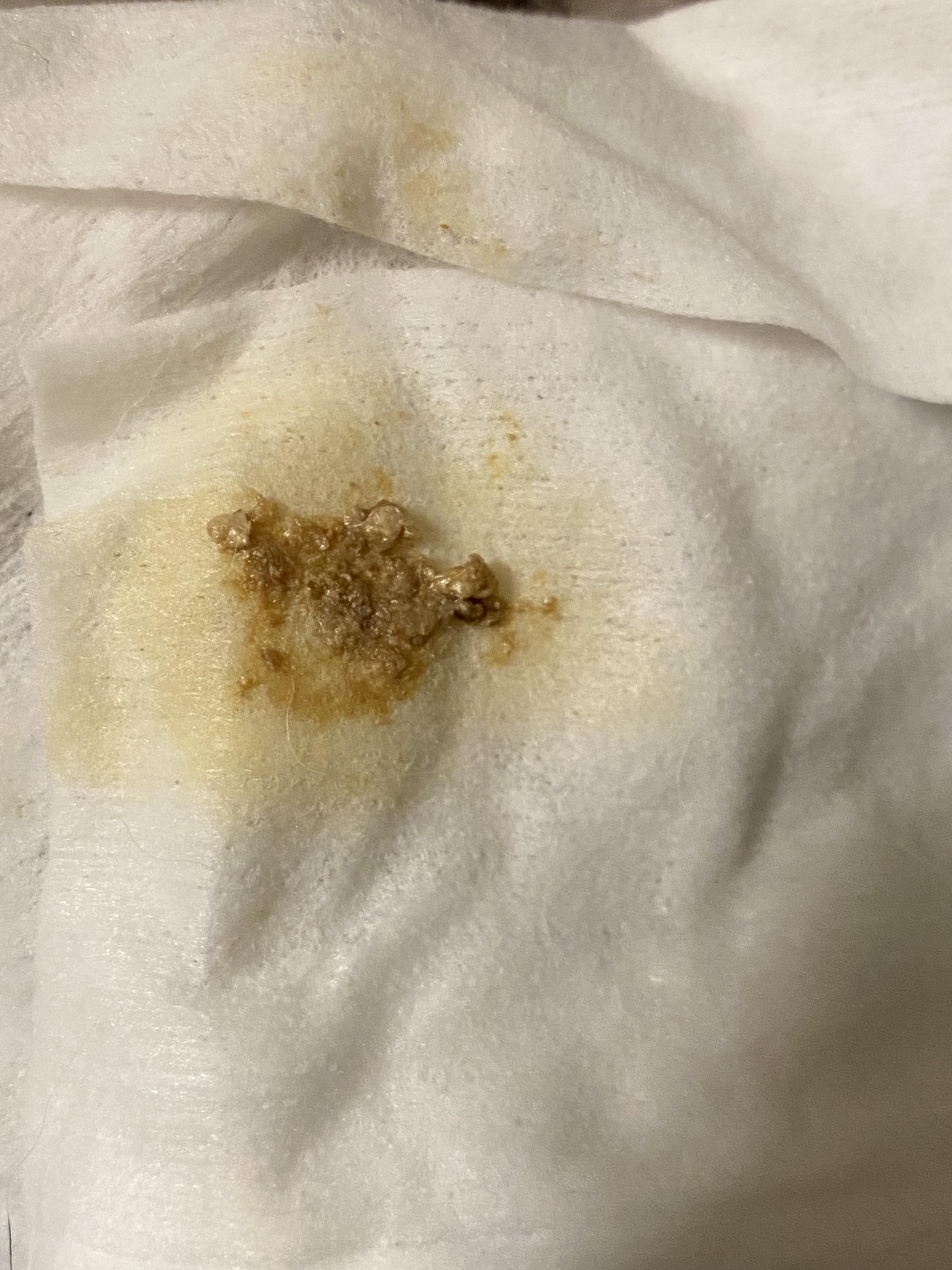 Anal Gland Discharge - Is this normal or concerning? : vet