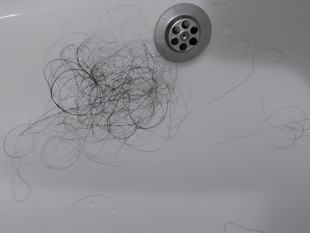 losing hair (after showering ı brushed my hair) is this much losing
