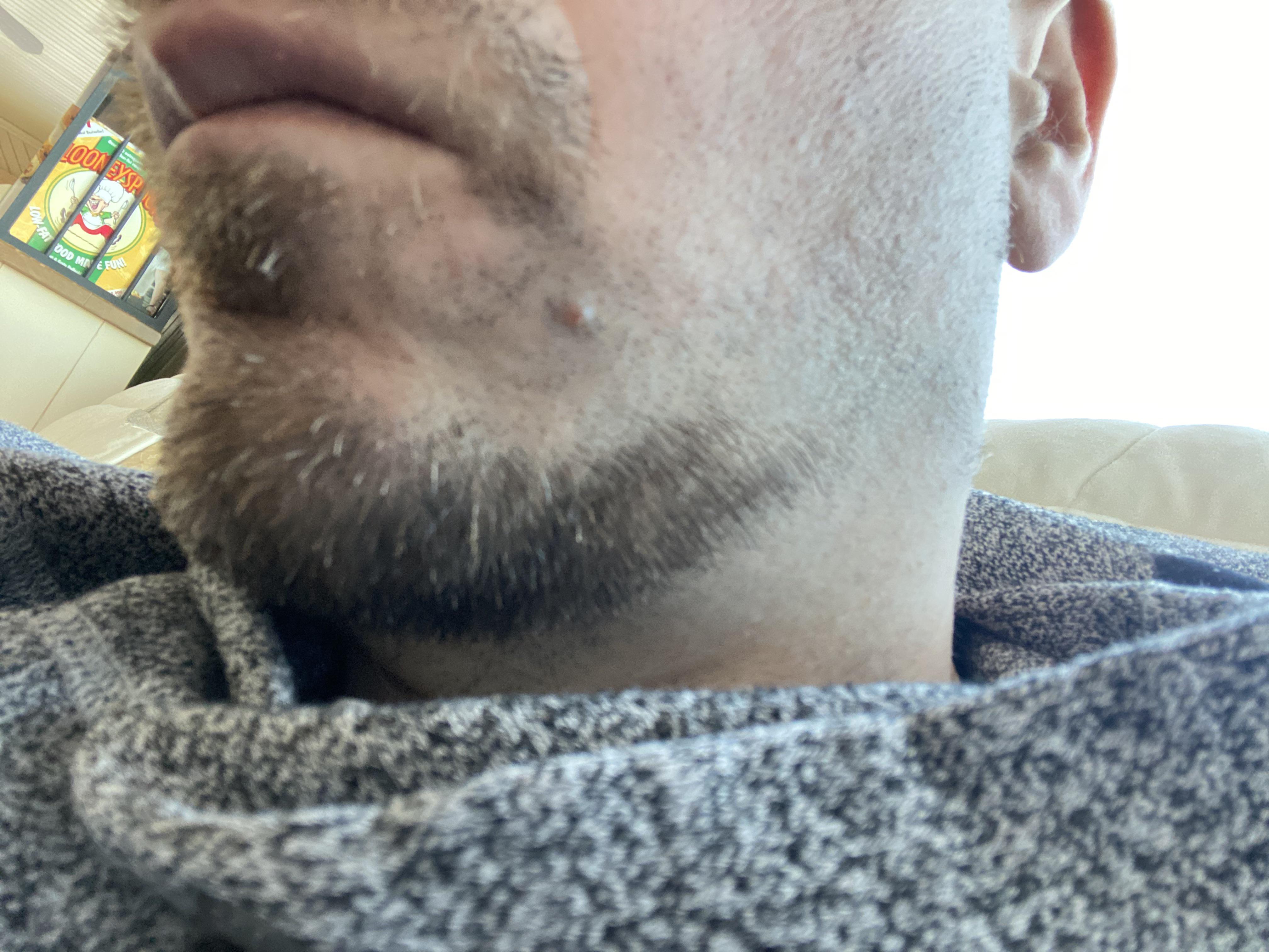 I have had a beard or goatee for the last 10 years and decided to shave