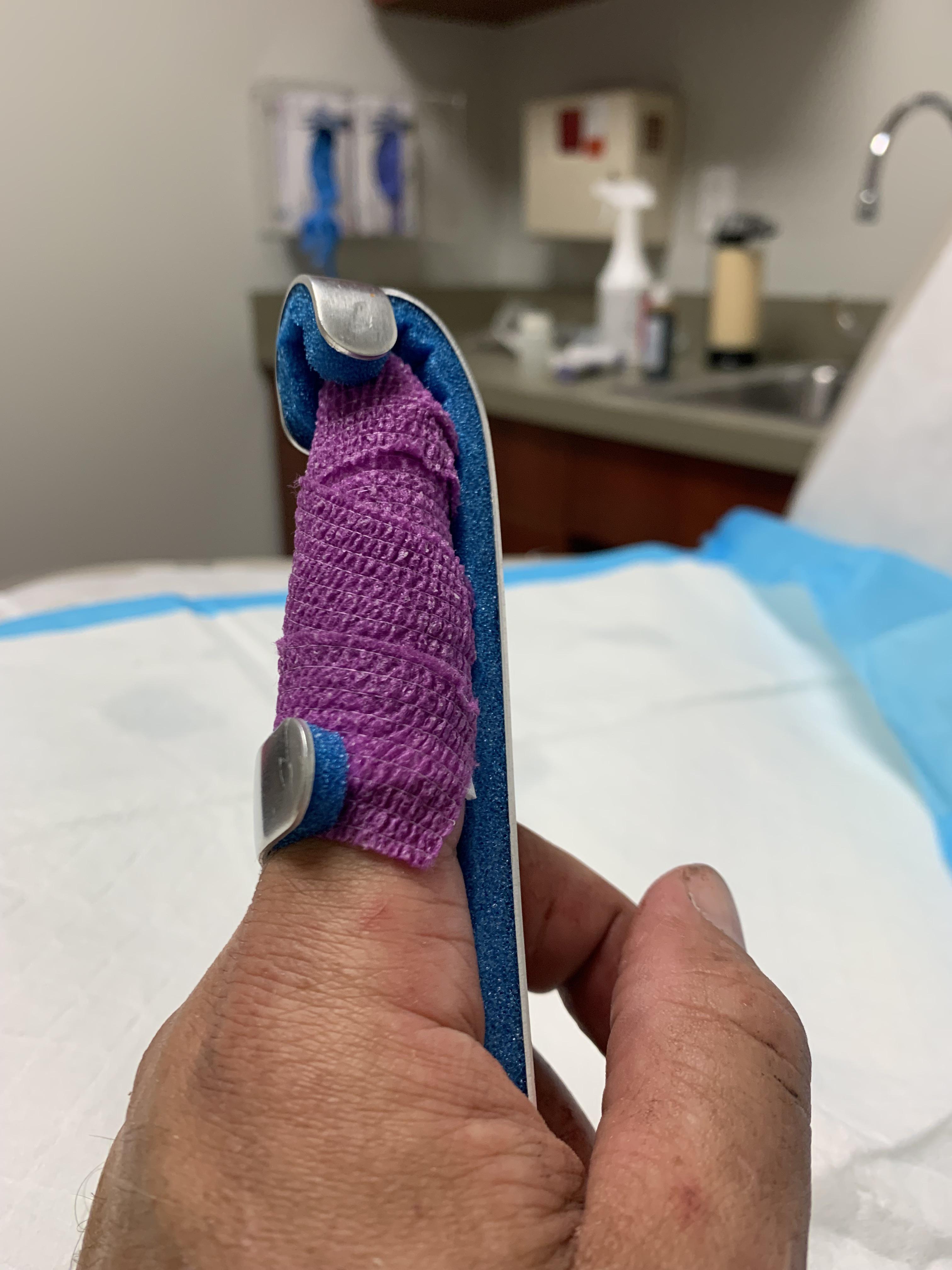 When using a router, remember safety third! r/woodworking