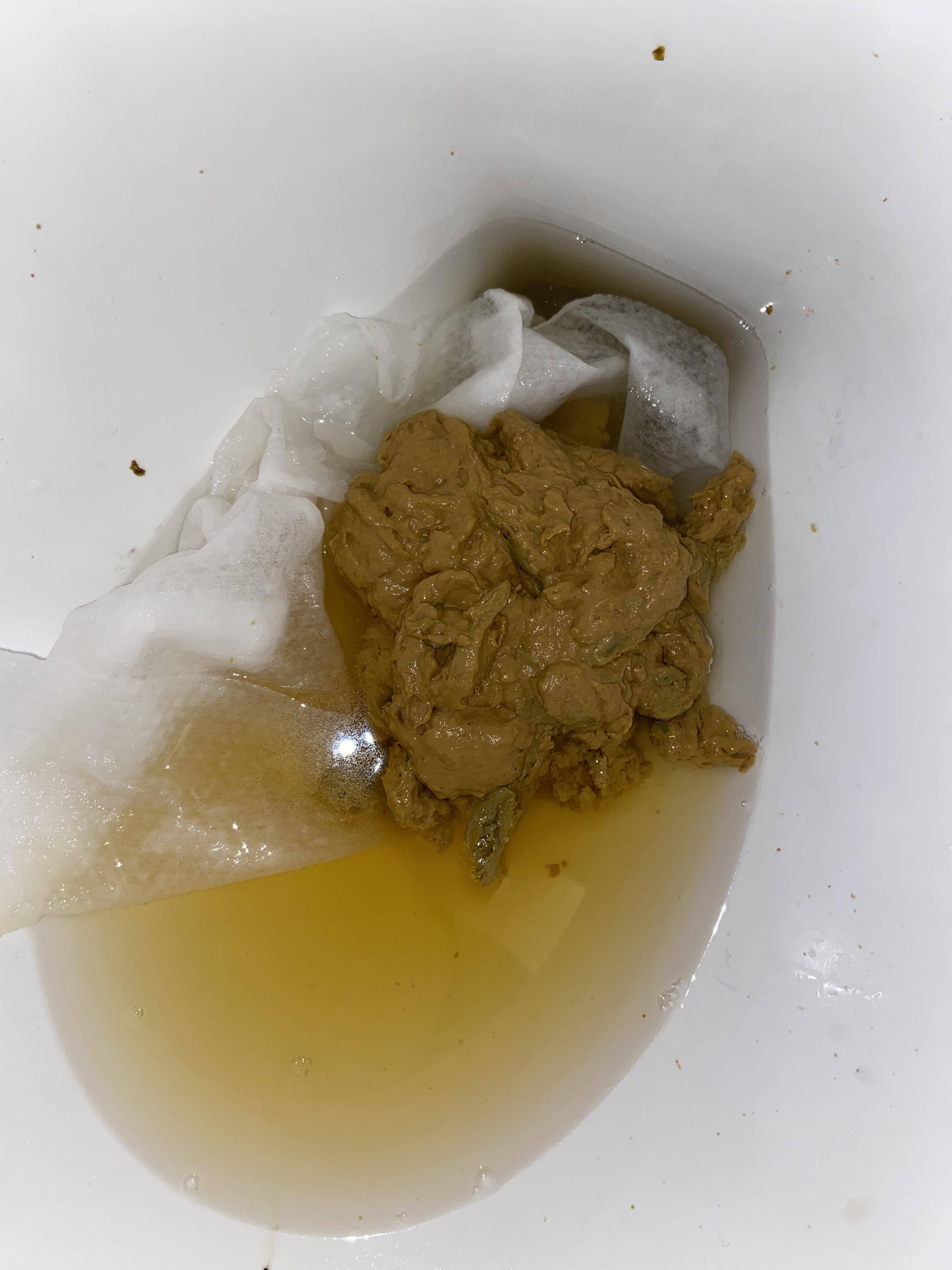 Does this look pale poop