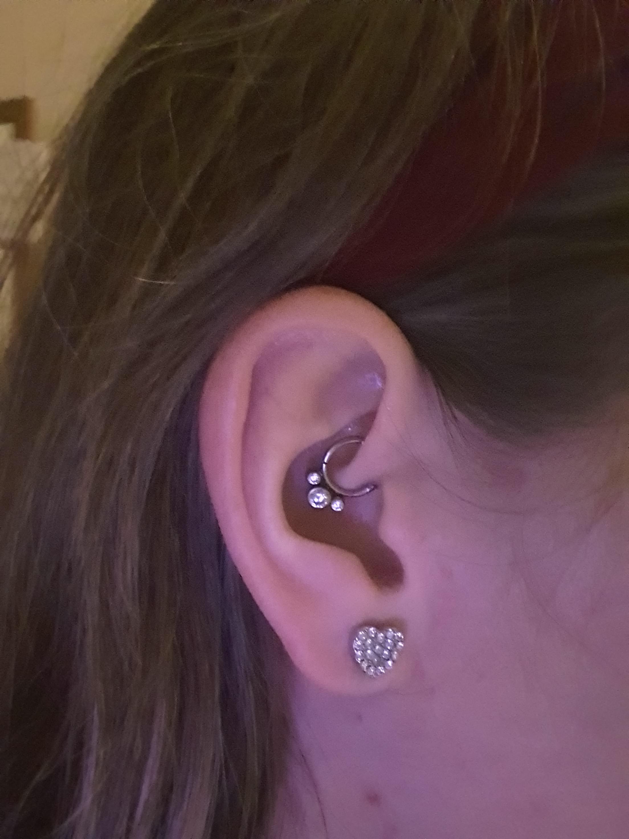 So this happened finally!! Can't wait to get my upper lobe done next 😍